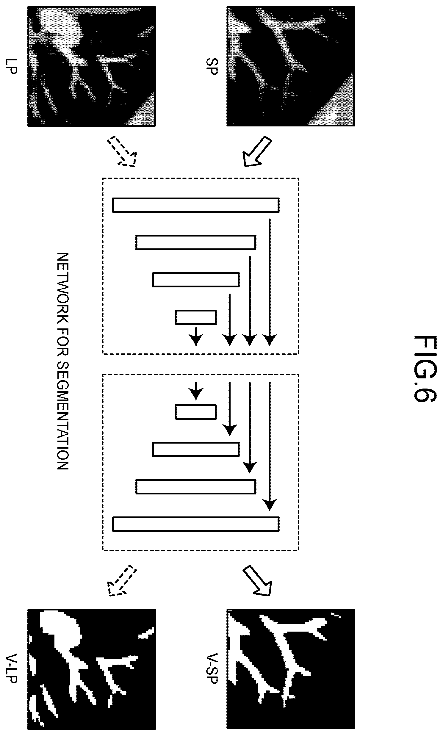 Patent US12437509 Figure 6 – Medical image processing apparatus, method, and storage medium