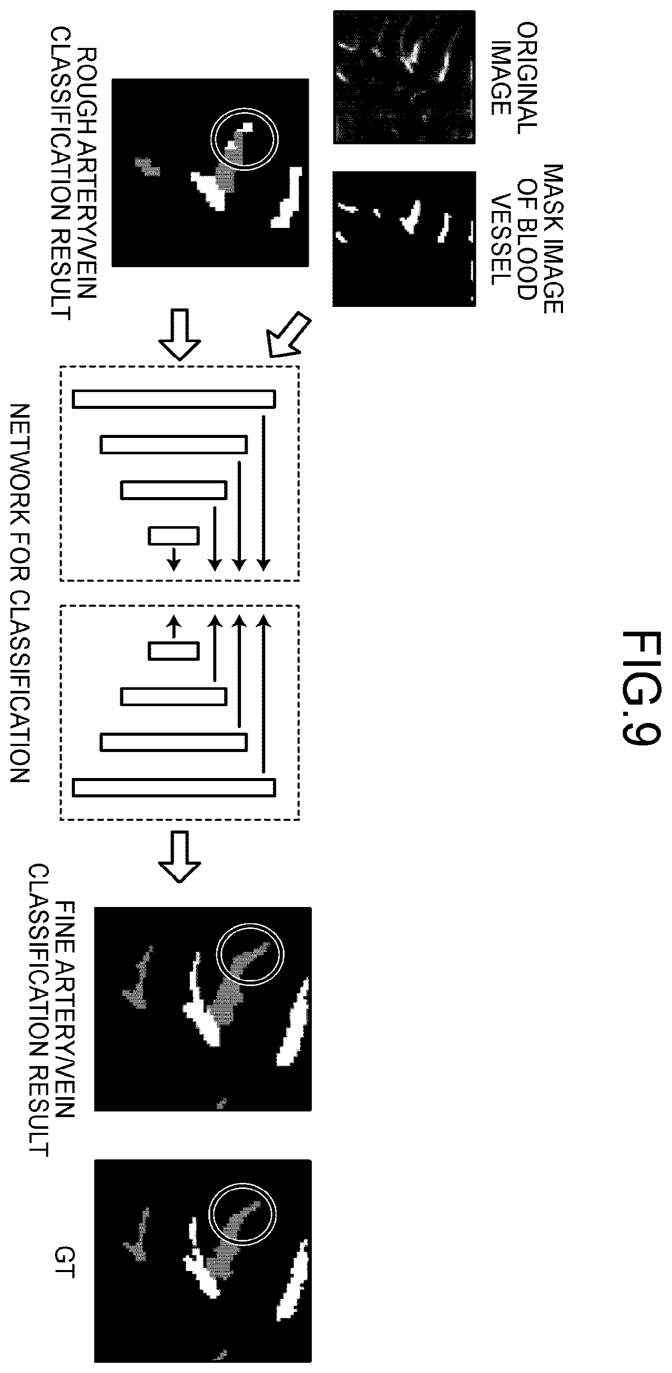 Patent US12437509 Figure 9 – Medical image processing apparatus, method, and storage medium