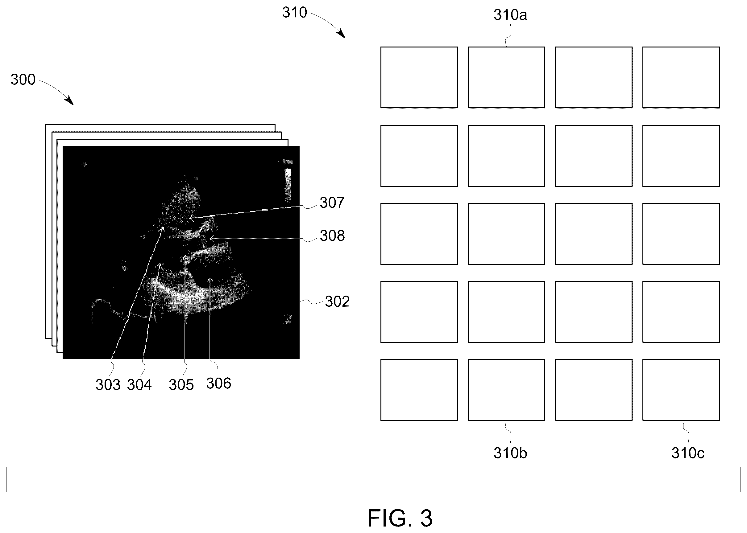 Patent US12437859 Figure 3 – Methods and systems for reviewing ultrasound images