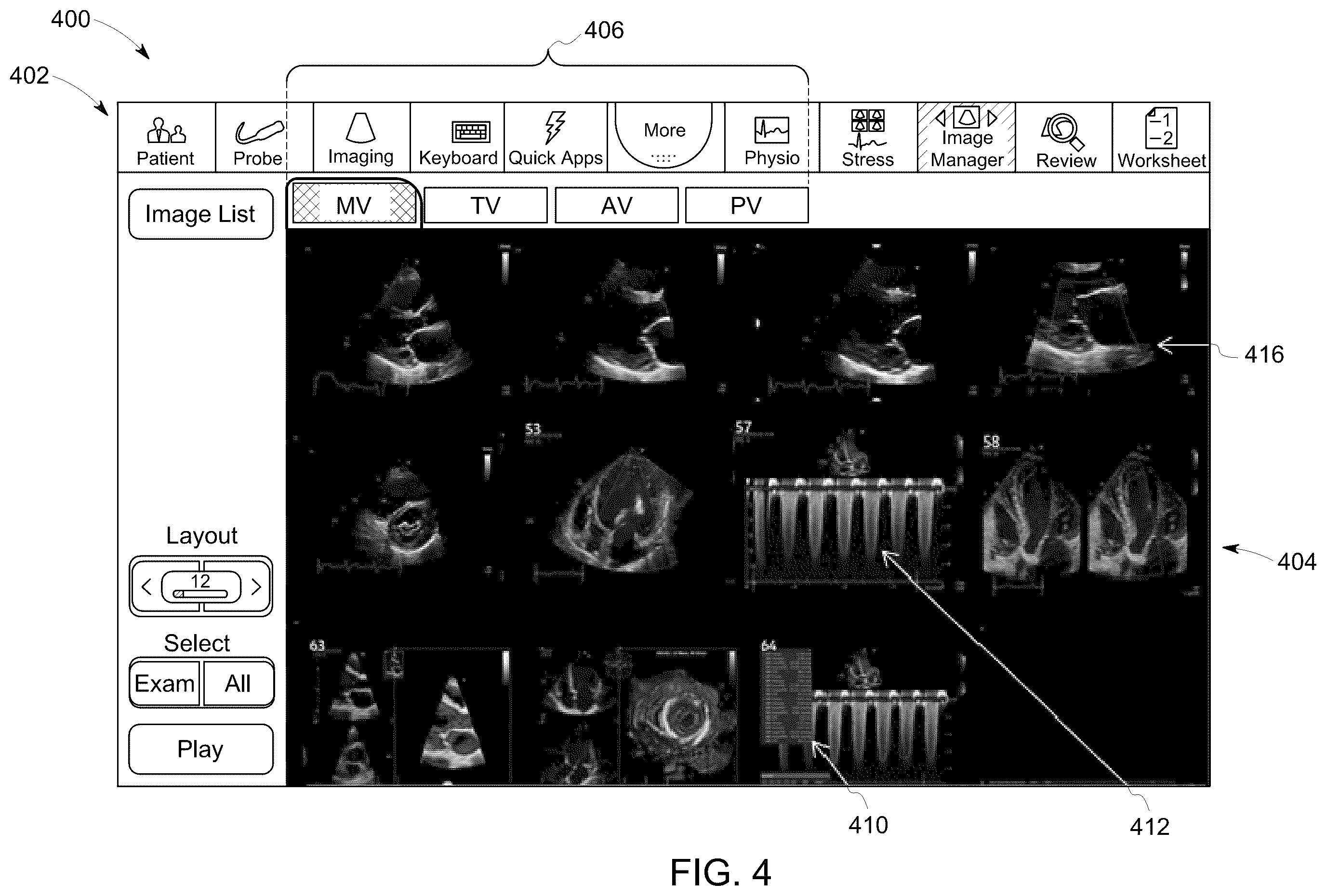 Patent US12437859 Figure 4 – Methods and systems for reviewing ultrasound images