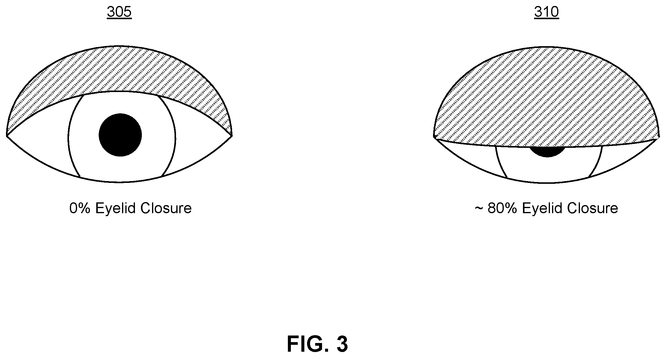 Patent US12437869 Figure 3 – Headset integrated into healthcare platform