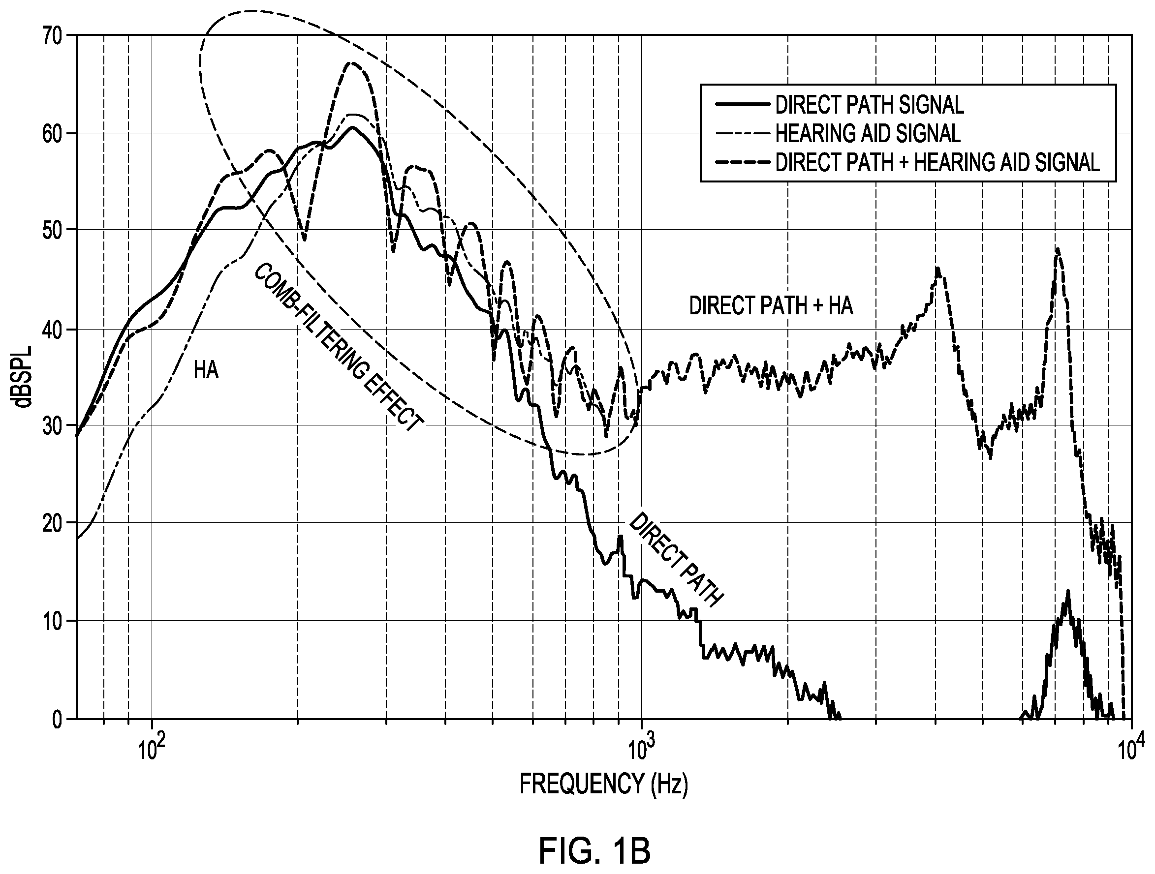 Patent US12445786 Figure 2 – Active noise control for sound quality in hearing devices