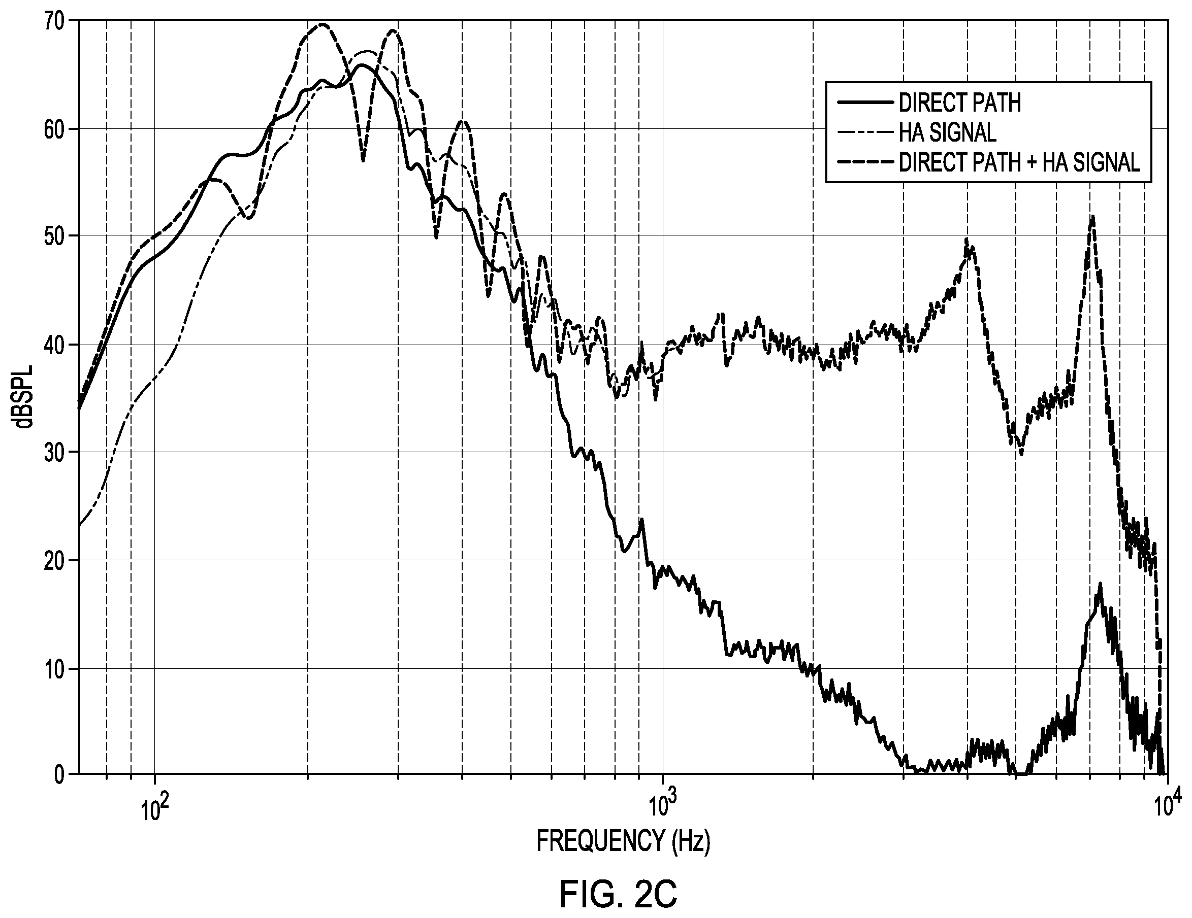 Patent US12445786 Figure 6 – Active noise control for sound quality in hearing devices