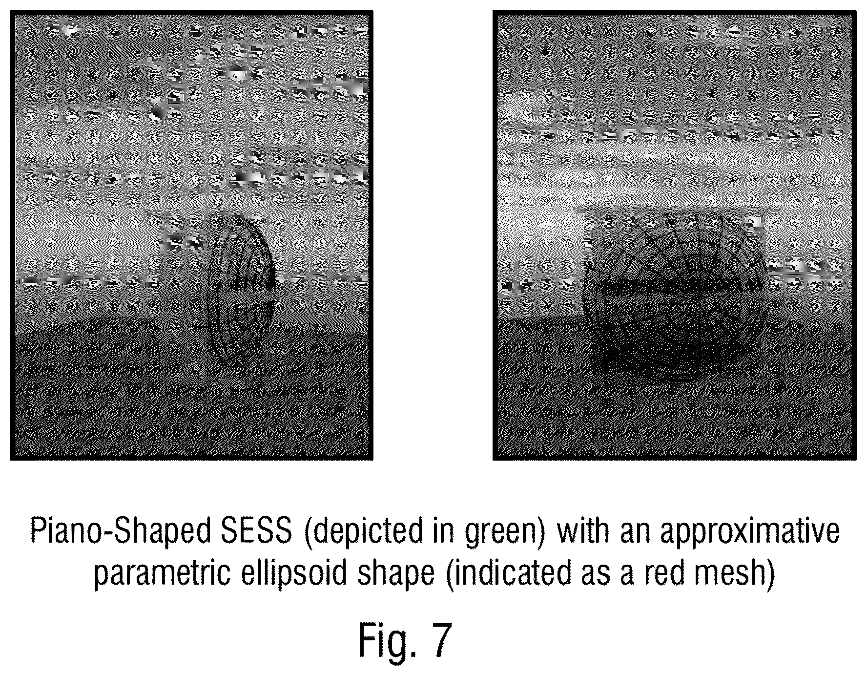 Patent US12445796 Figure 7 – Apparatus and method for reproducing a spatially extended sound source or apparatus and method for generating a bitstream from a spatially extended sound source