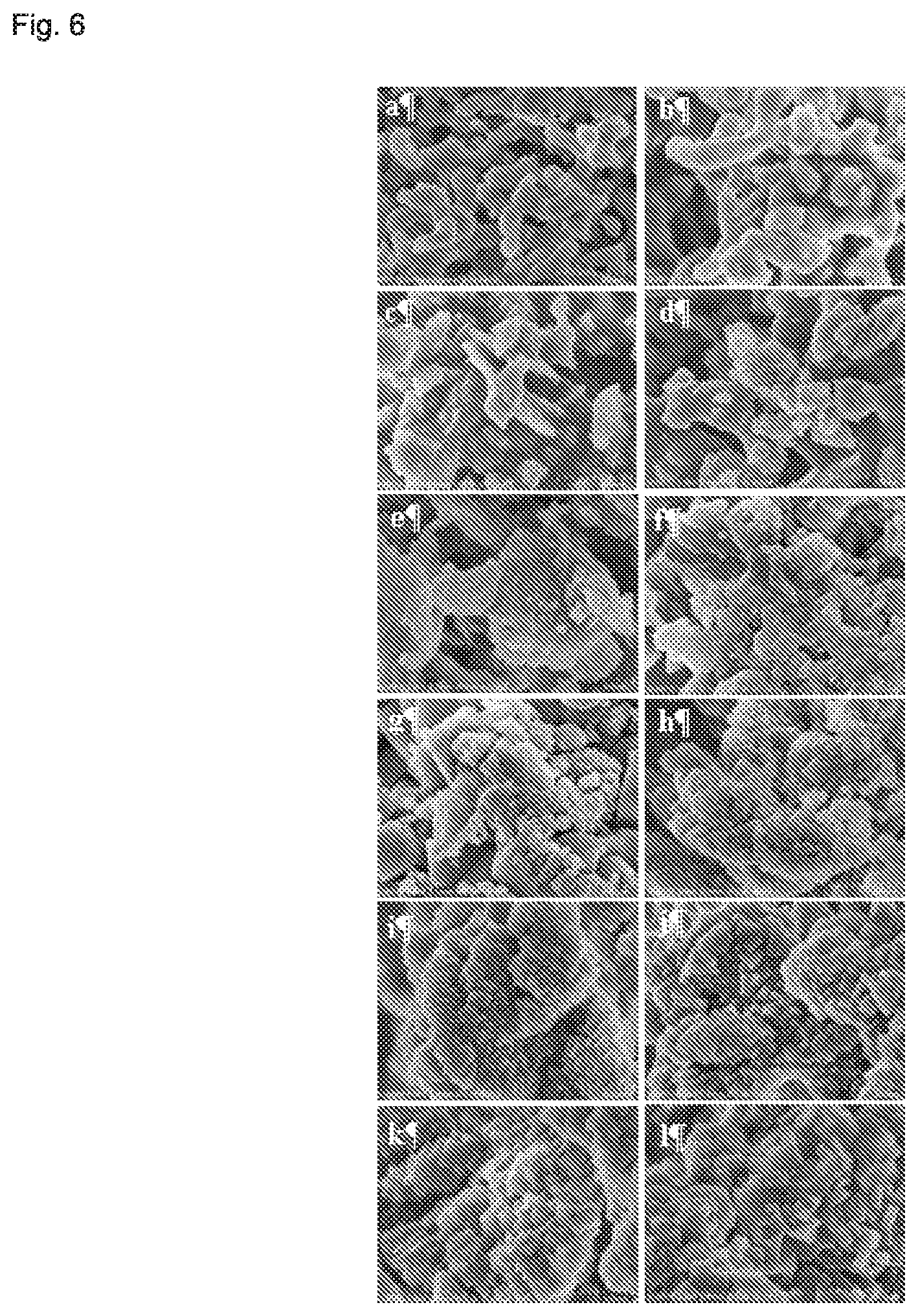 Patent US12448296 Figure 6 – Oxidic material comprising a zeolite having framework type AEI