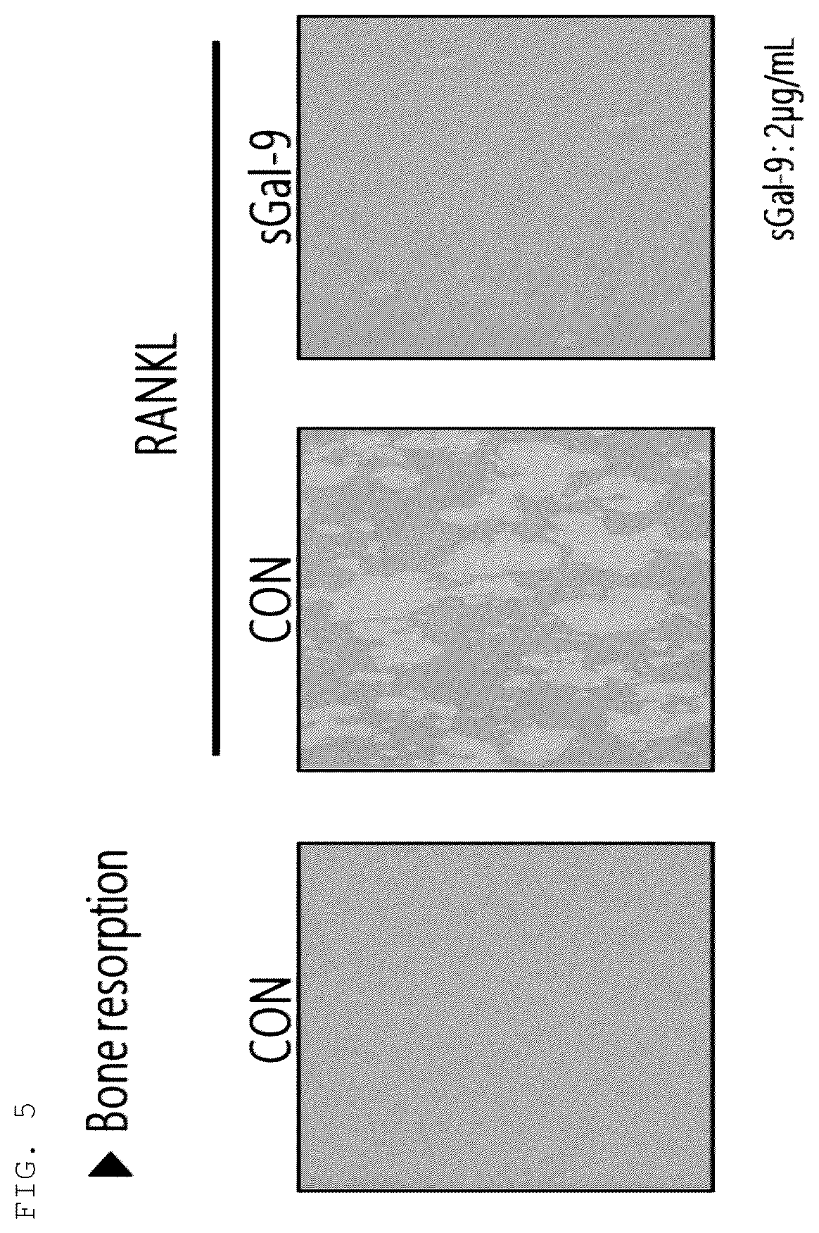 Patent US12448420 Figure 3 – Pharmaceutical composition, comprising recombinant stabilized galectin 9 protein, for prevention or treatment of rheumatoid arthritis and bone disease