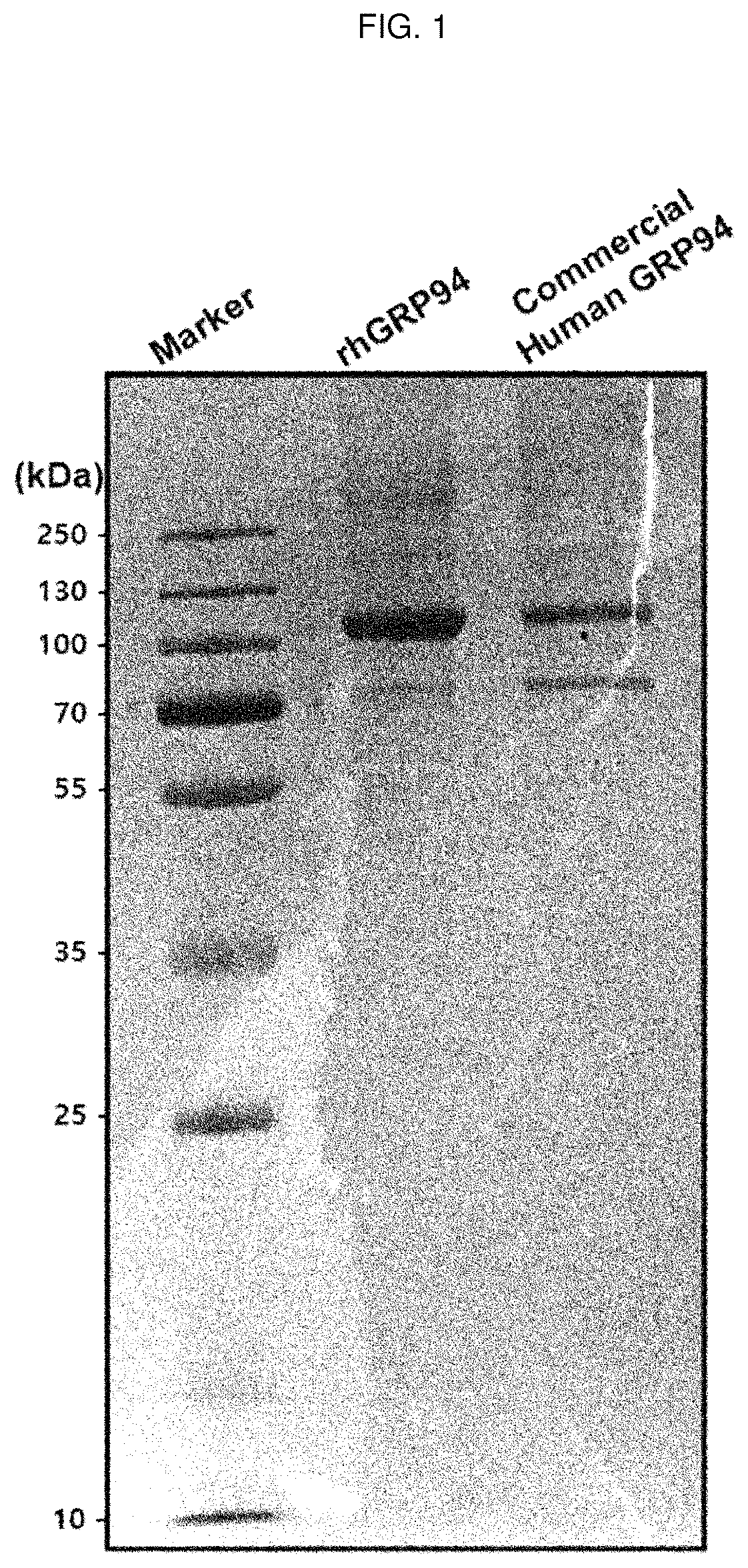 Patent US12448436 Figure 1 – Antibody specifically binding to GRP94 or antigen-binding fragment thereof, and uses thereof