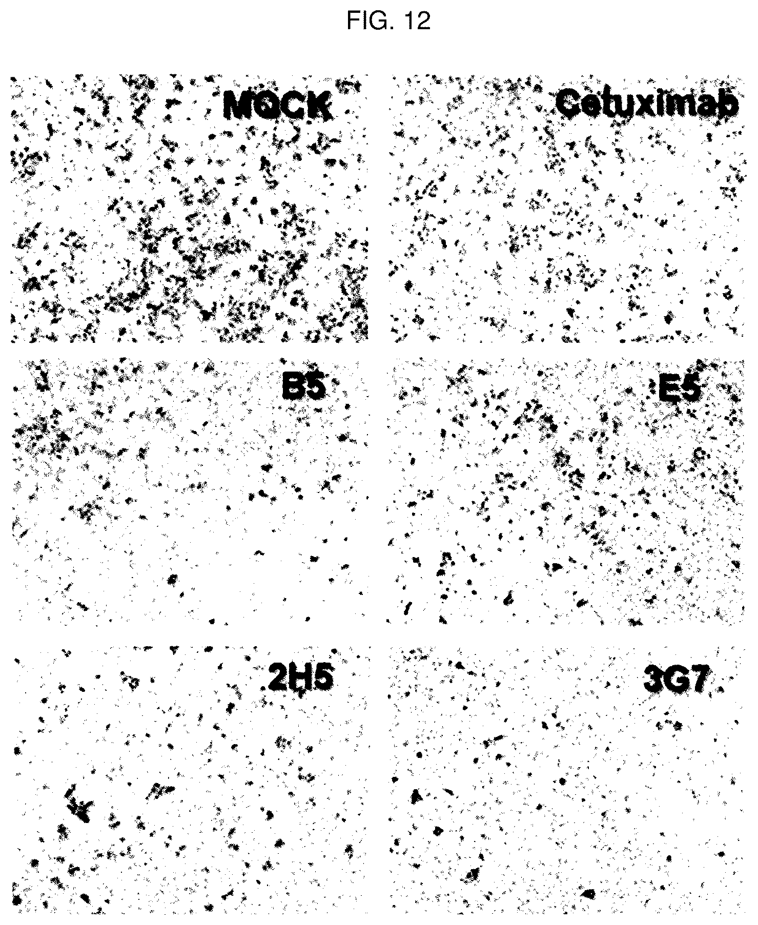 Patent US12448436 Figure 12 – Antibody specifically binding to GRP94 or antigen-binding fragment thereof, and uses thereof