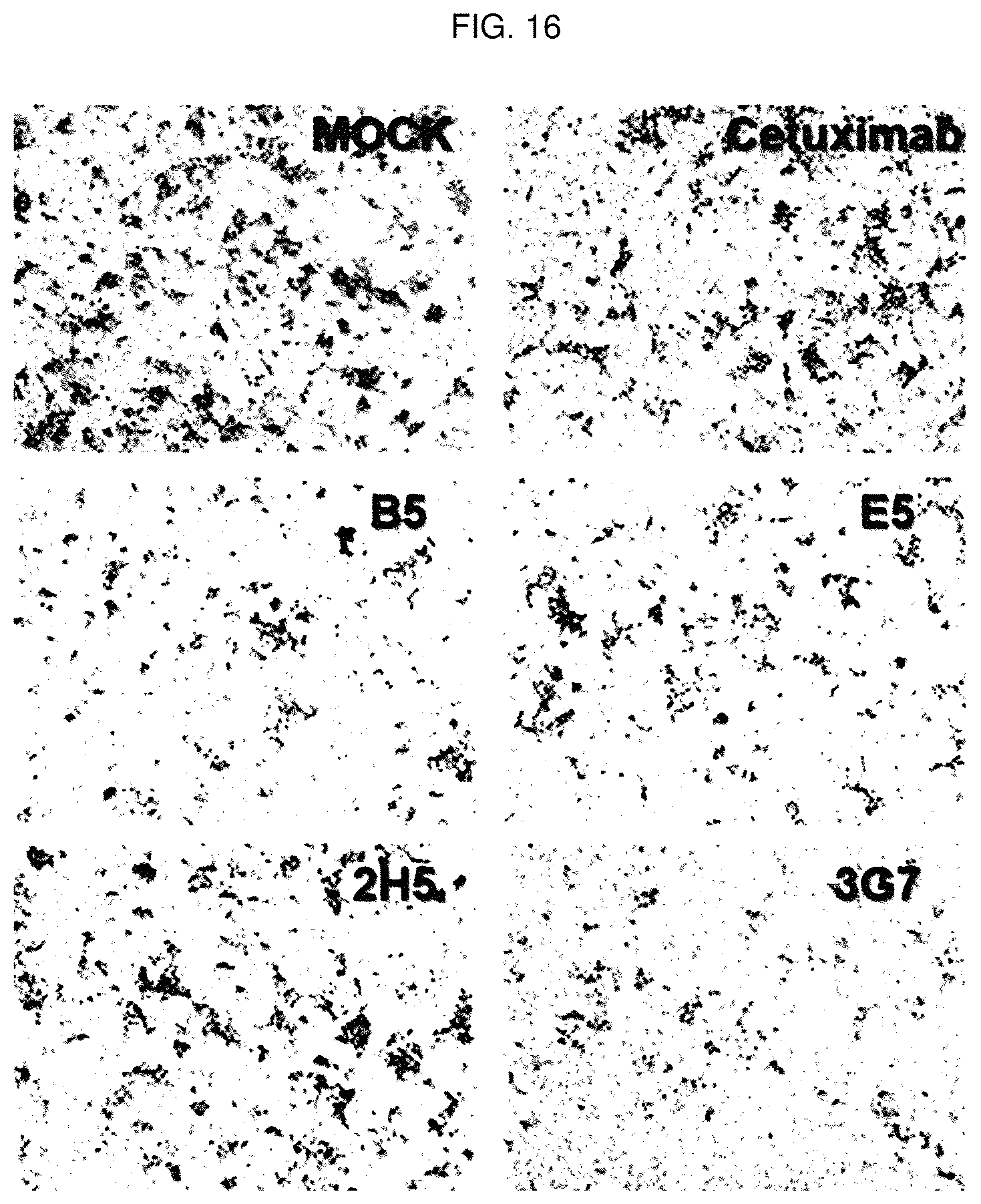Patent US12448436 Figure 16 – Antibody specifically binding to GRP94 or antigen-binding fragment thereof, and uses thereof