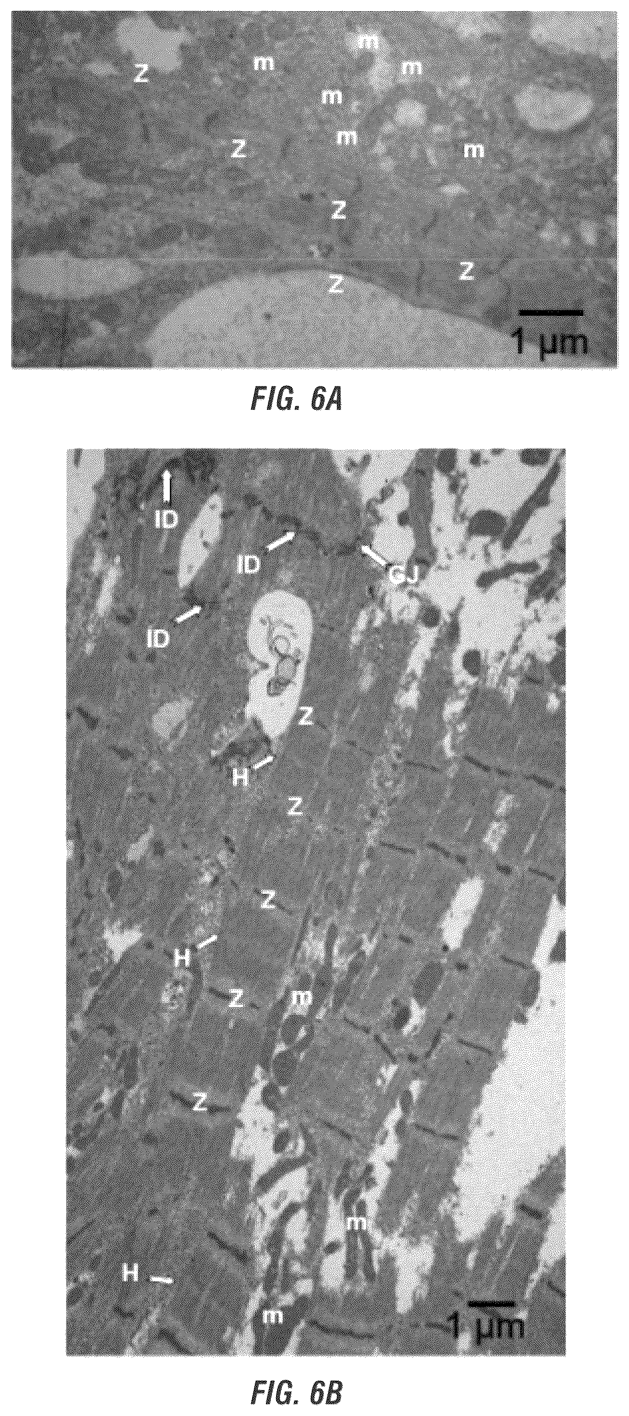 Patent US12448605 Figure 10 – Encapsulation and cardiac differentiation of hiPSCs in 3D PEG-fibrinogen hydrogels