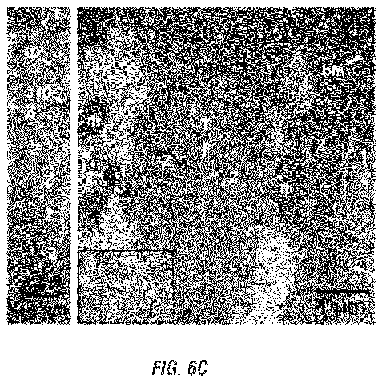 Patent US12448605 Figure 11 – Encapsulation and cardiac differentiation of hiPSCs in 3D PEG-fibrinogen hydrogels
