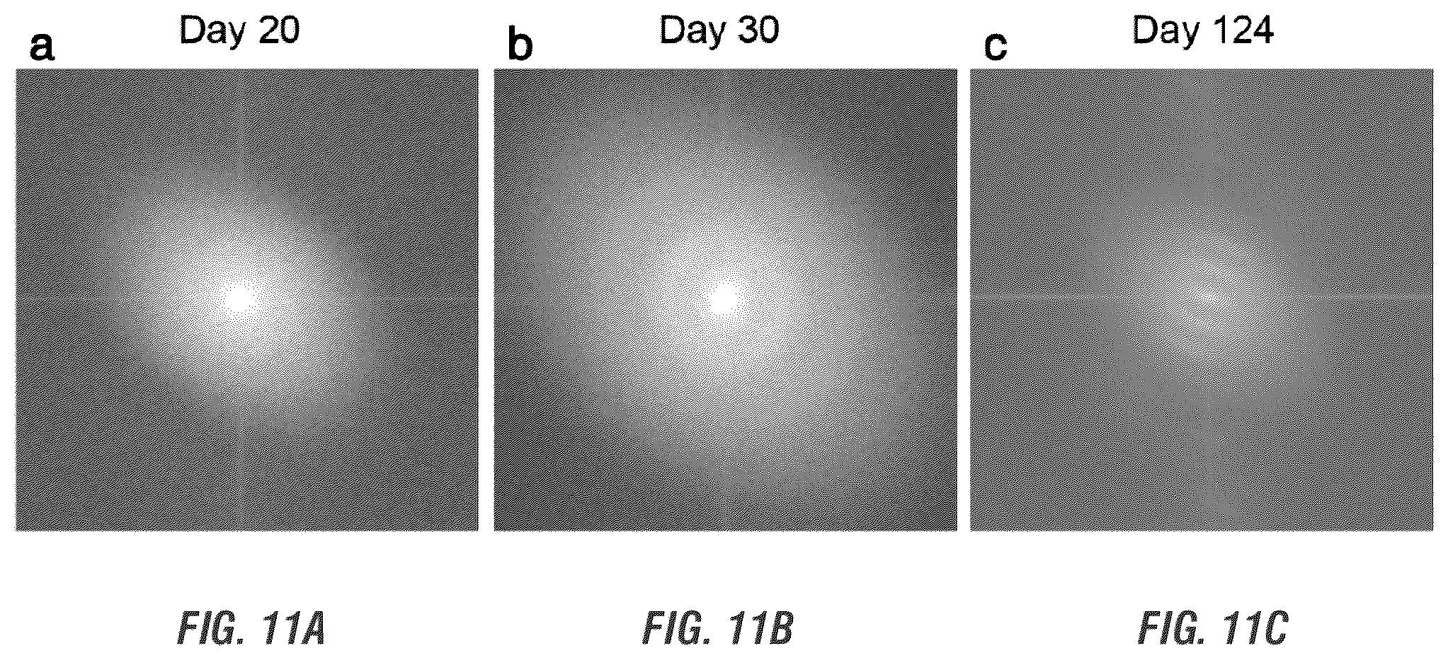 Patent US12448605 Figure 18 – Encapsulation and cardiac differentiation of hiPSCs in 3D PEG-fibrinogen hydrogels
