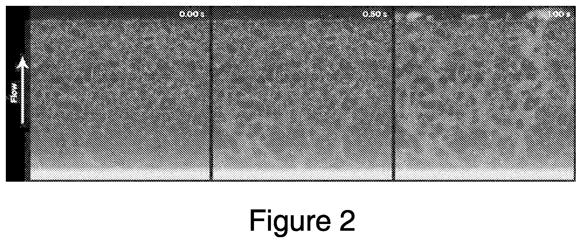 Patent US12448607 Figure 2 – Systems and methods for multilane vasculature