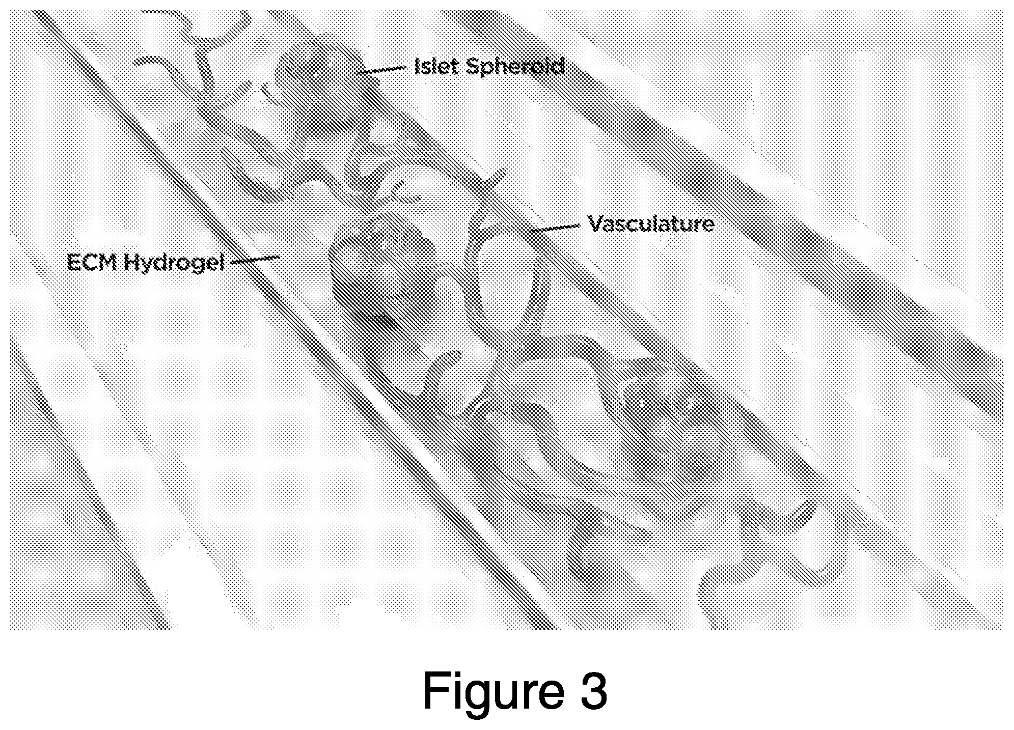 Patent US12448607 Figure 3 – Systems and methods for multilane vasculature