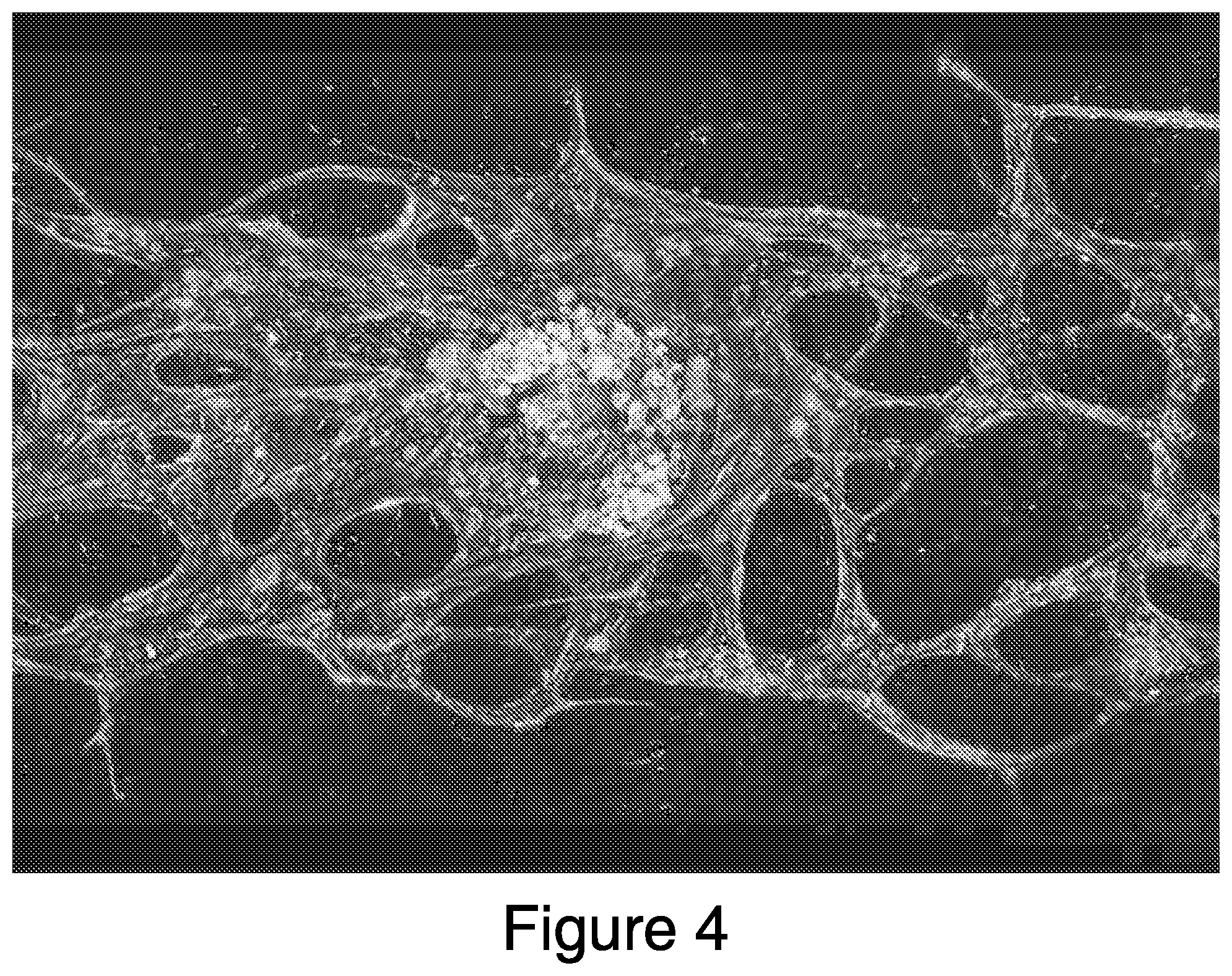 Patent US12448607 Figure 4 – Systems and methods for multilane vasculature