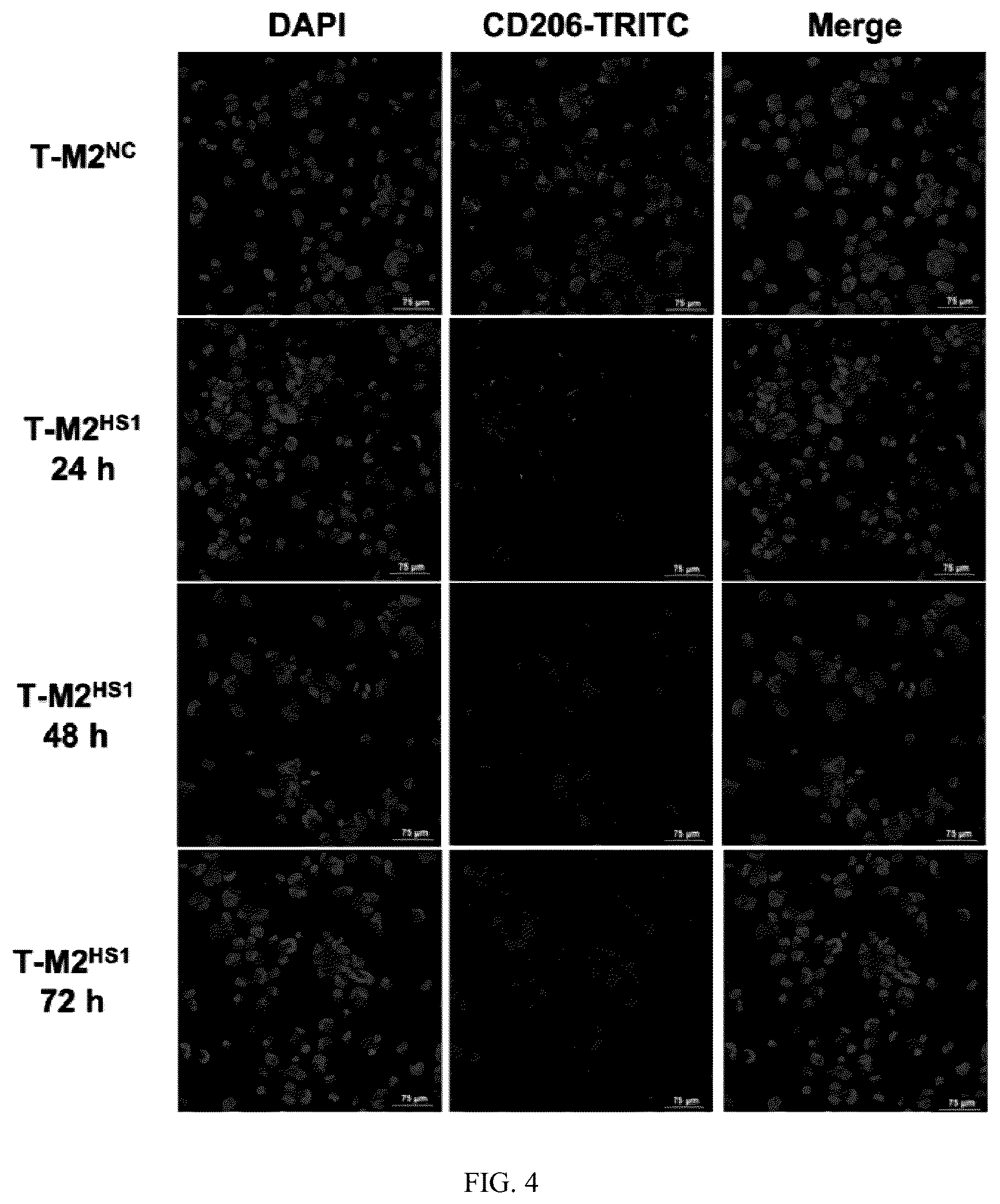 Patent US12448623 Figure 3 – siRNA specifically binding to M2 macrophage CD206 and application thereof
