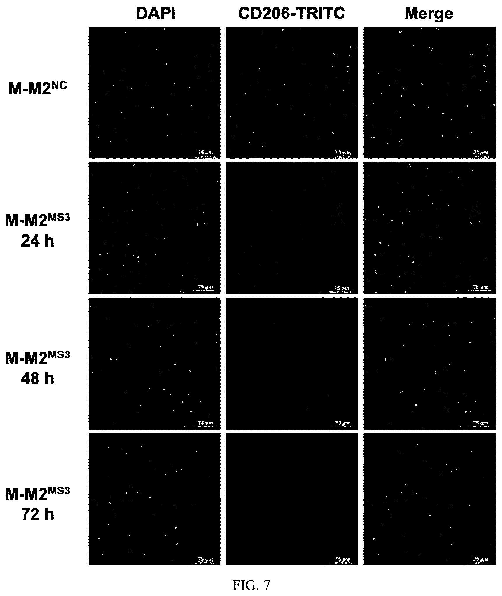 Patent US12448623 Figure 5 – siRNA specifically binding to M2 macrophage CD206 and application thereof
