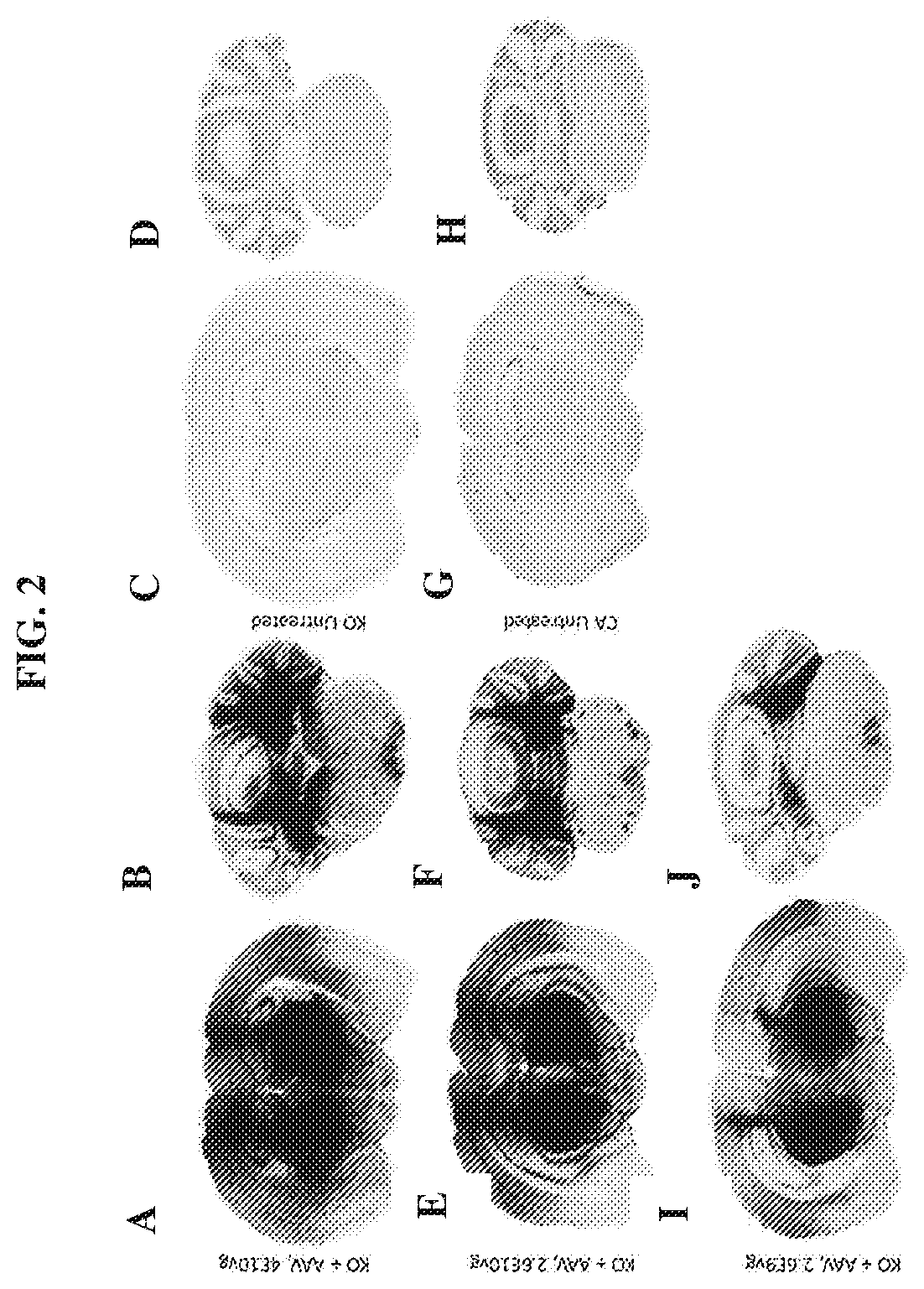 Patent US12448629 Figure 2 – rAAV vectors for the treatment of GM1 and GM2 gangliosidosis