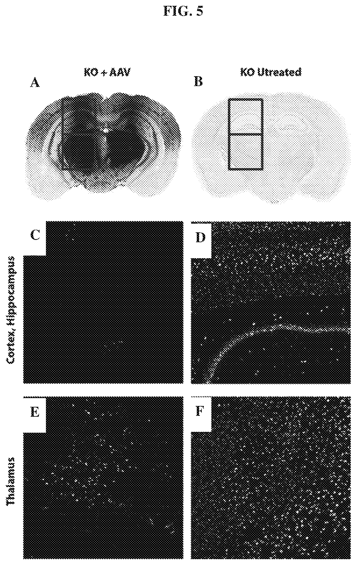 Patent US12448629 Figure 5 – rAAV vectors for the treatment of GM1 and GM2 gangliosidosis