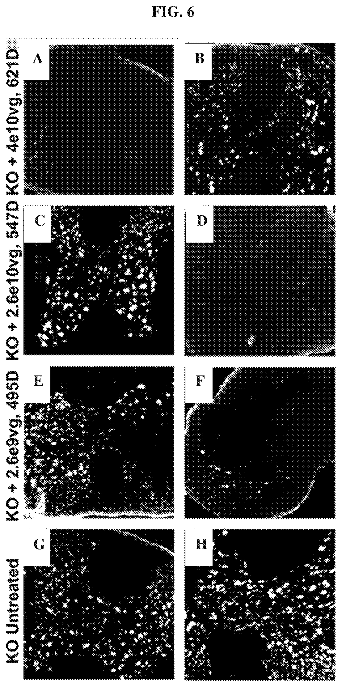 Patent US12448629 Figure 6 – rAAV vectors for the treatment of GM1 and GM2 gangliosidosis