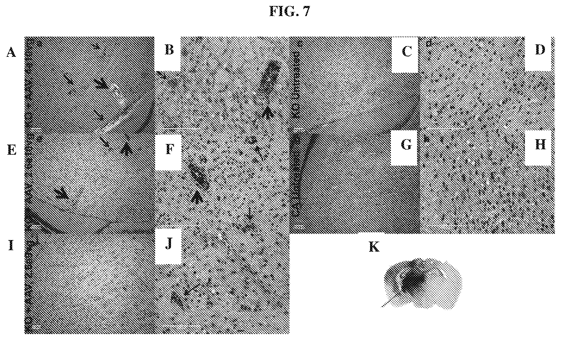 Patent US12448629 Figure 7 – rAAV vectors for the treatment of GM1 and GM2 gangliosidosis