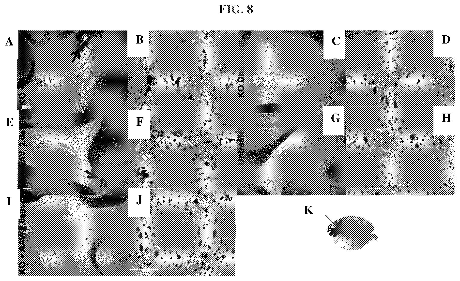 Patent US12448629 Figure 8 – rAAV vectors for the treatment of GM1 and GM2 gangliosidosis