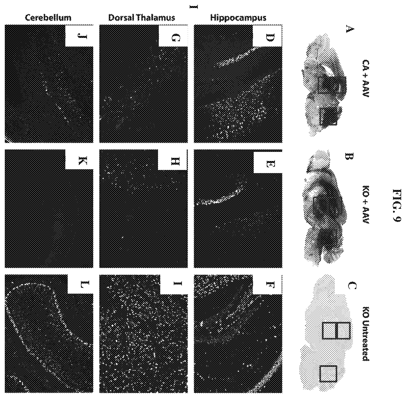 Patent US12448629 Figure 9 – rAAV vectors for the treatment of GM1 and GM2 gangliosidosis