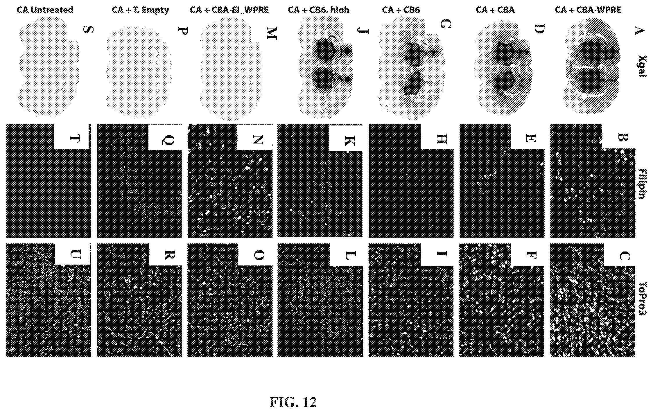 Patent US12448629 Figure 12 – rAAV vectors for the treatment of GM1 and GM2 gangliosidosis