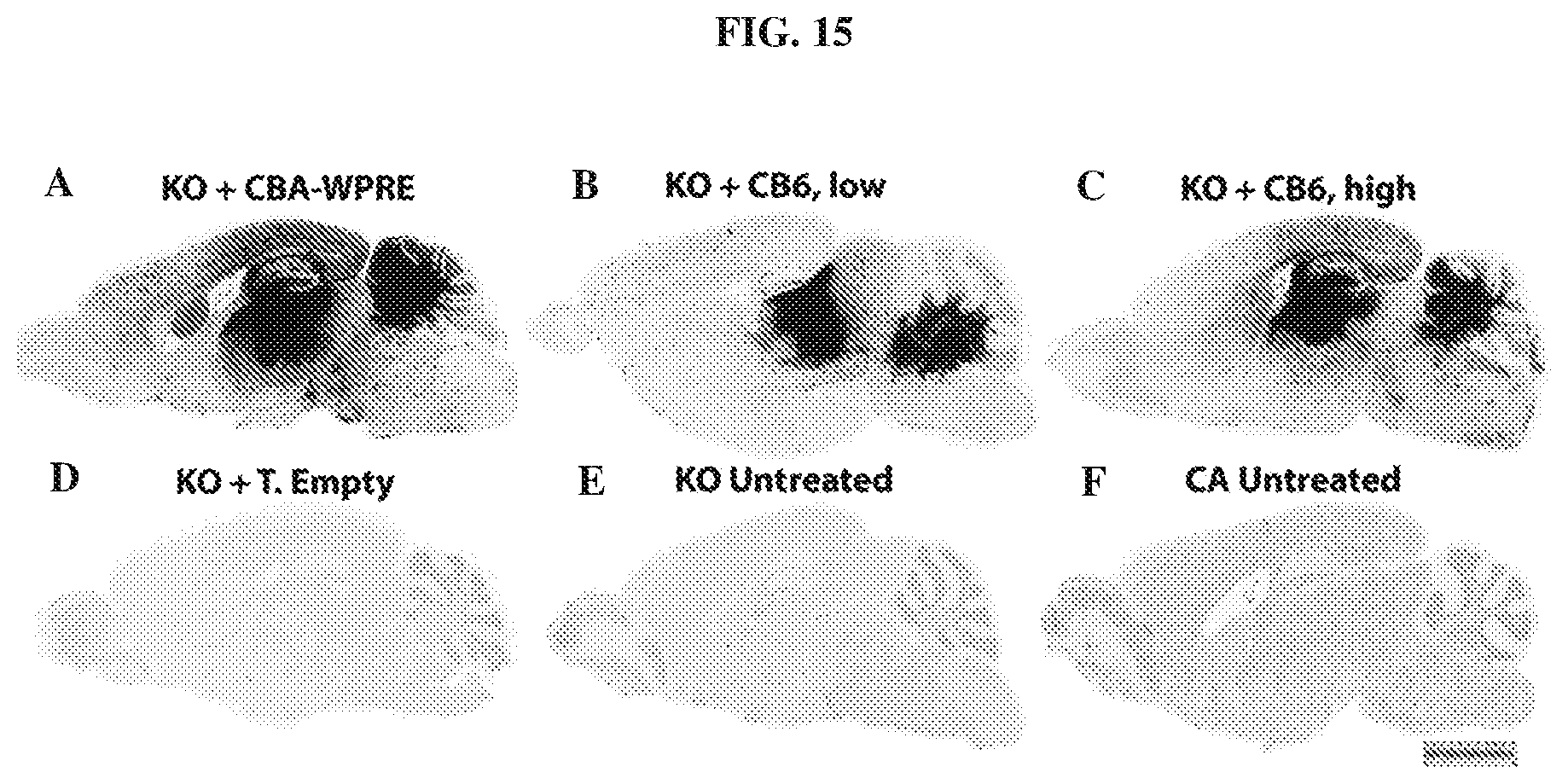 Patent US12448629 Figure 15 – rAAV vectors for the treatment of GM1 and GM2 gangliosidosis