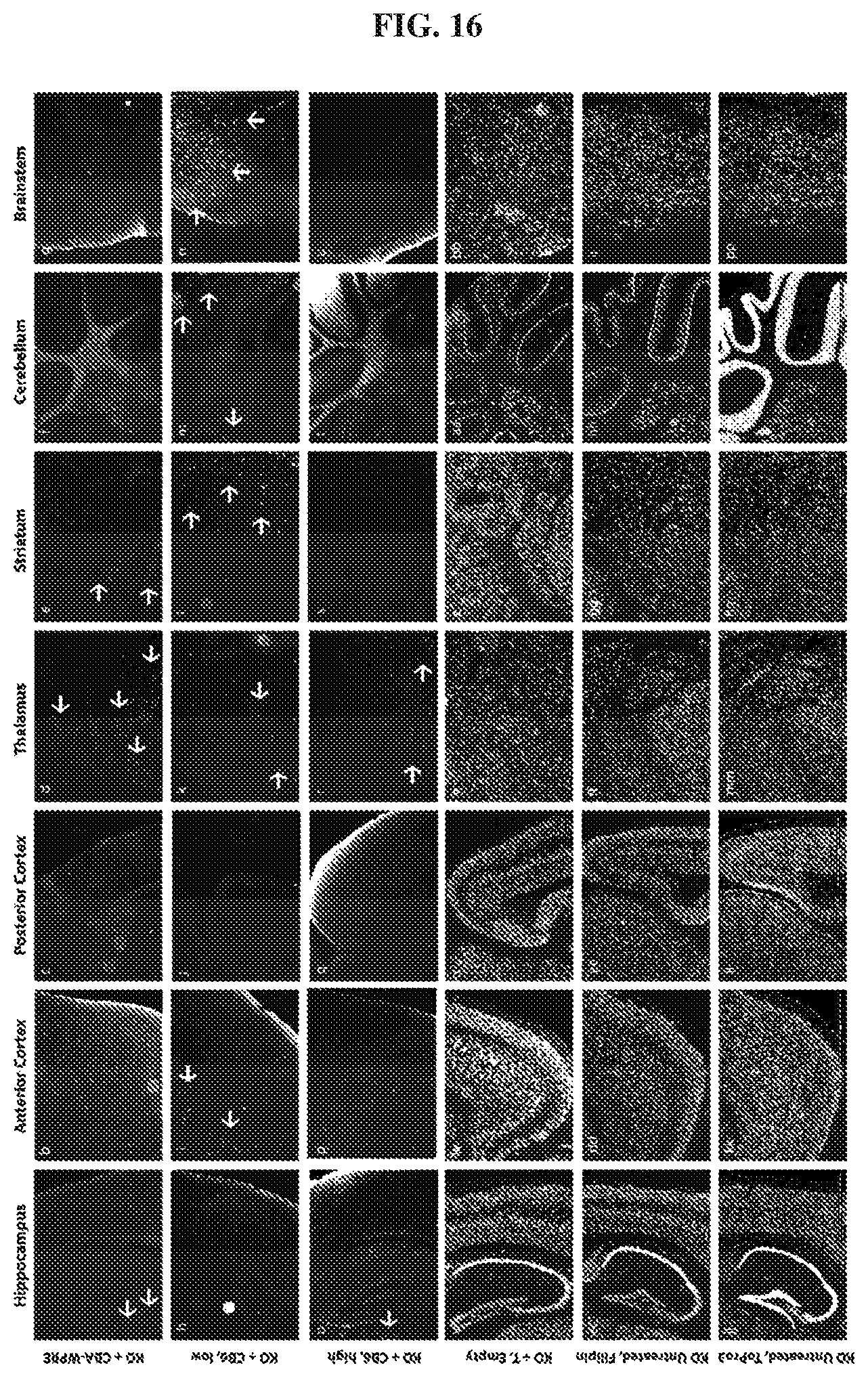 Patent US12448629 Figure 16 – rAAV vectors for the treatment of GM1 and GM2 gangliosidosis