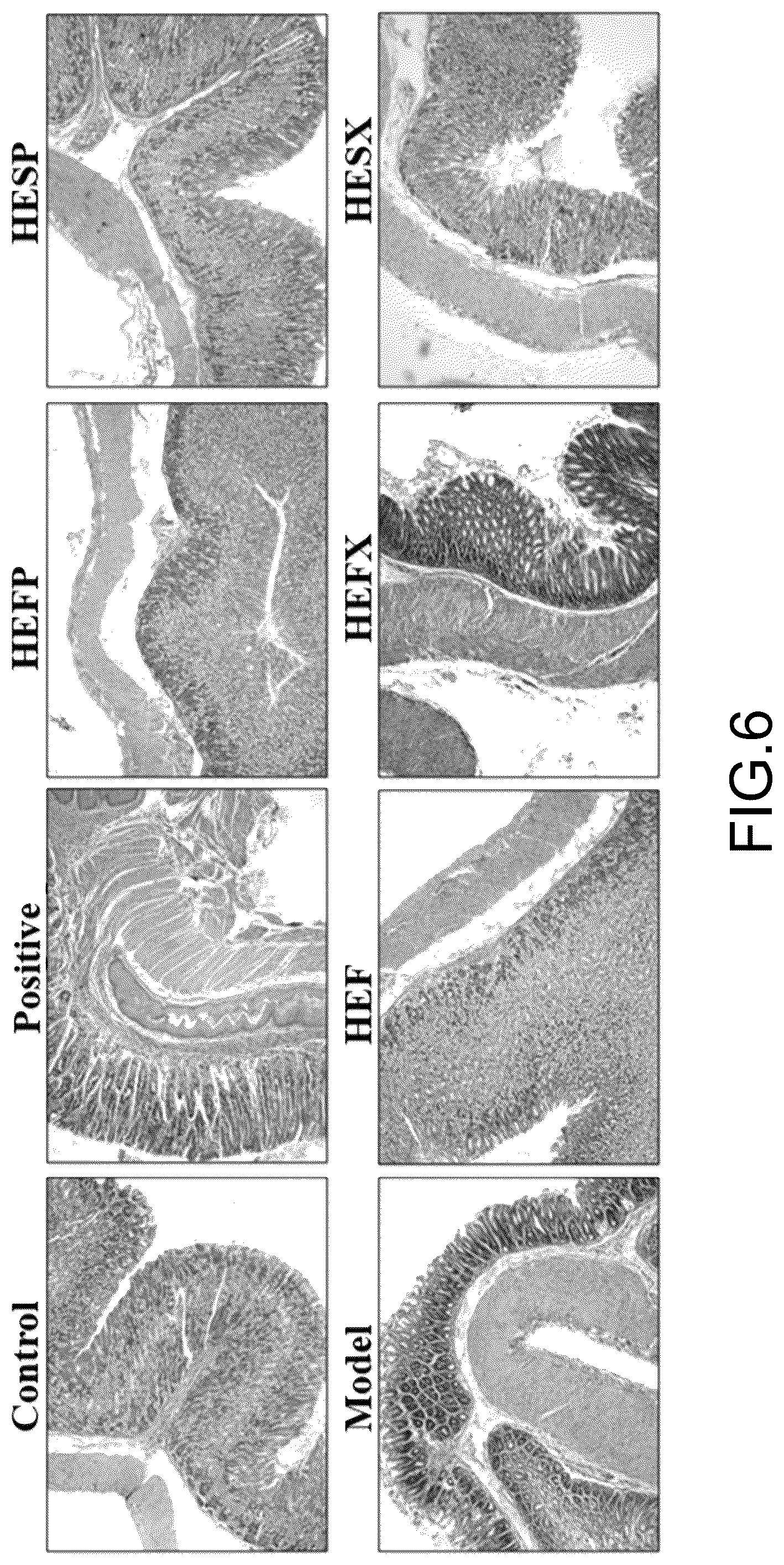 Patent US12448657 Figure 5 – Hericium erinaceus strain HE015, molecular markers and uses thereof