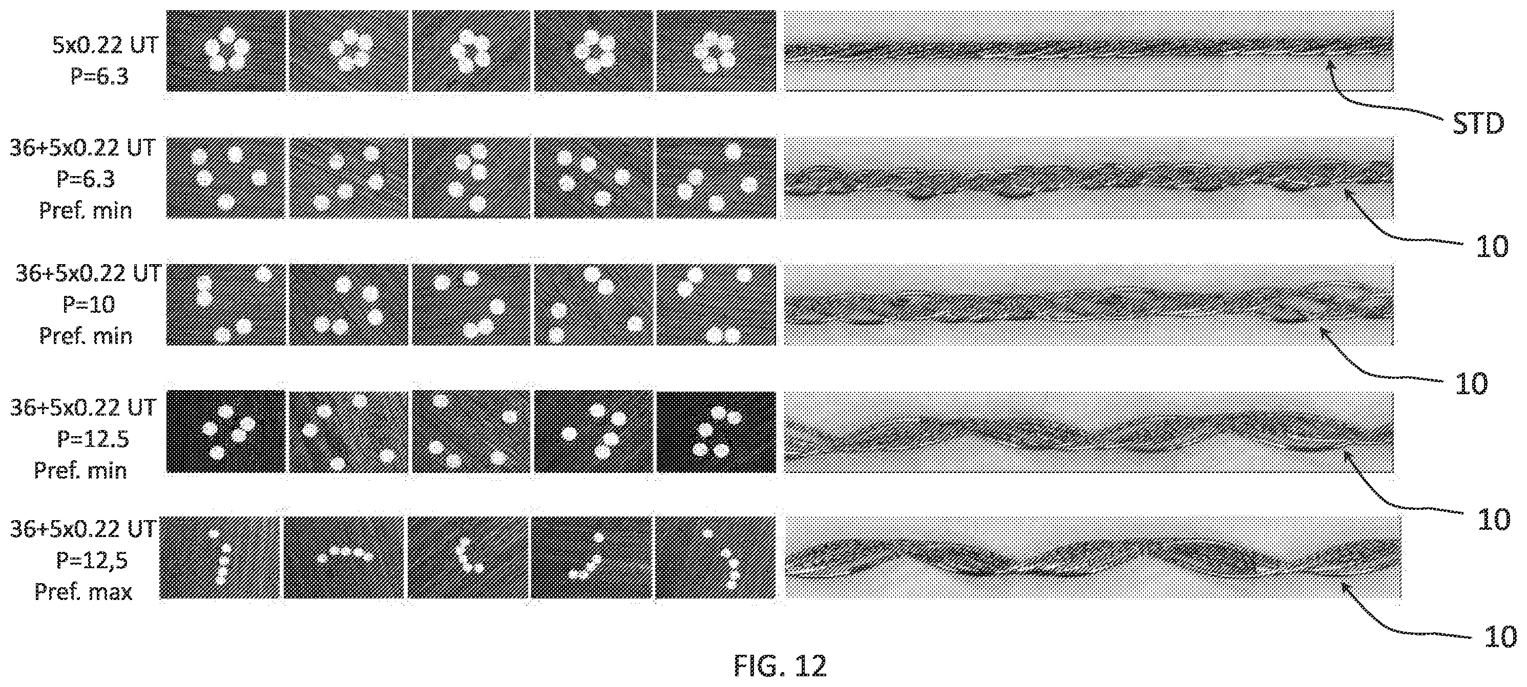 Patent US12448729 Figure 12 – Vehicle wheels and tyre comprising said metallic reinforcing cord