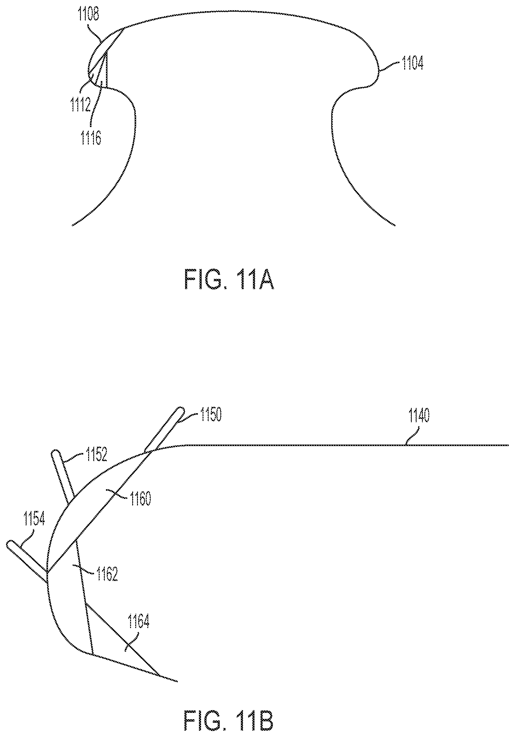 Patent US12448747 Figure 9 – Mobile waterjet rail repair system