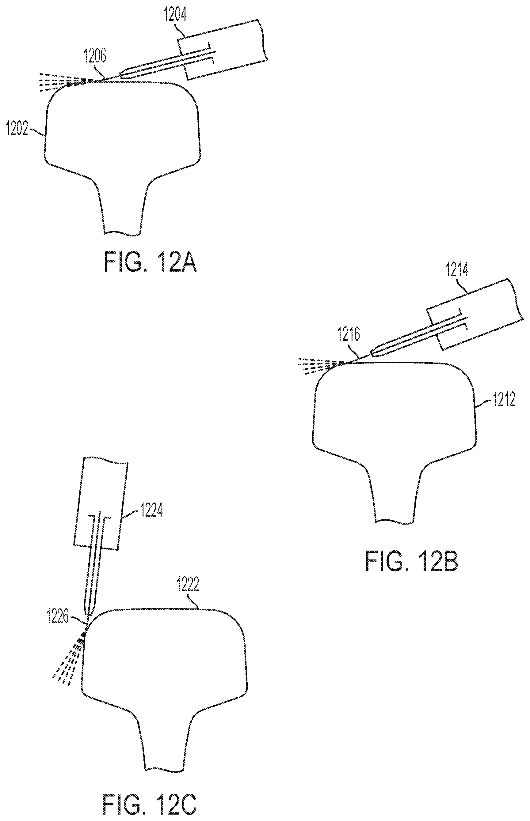 Patent US12448747 Figure 10 – Mobile waterjet rail repair system