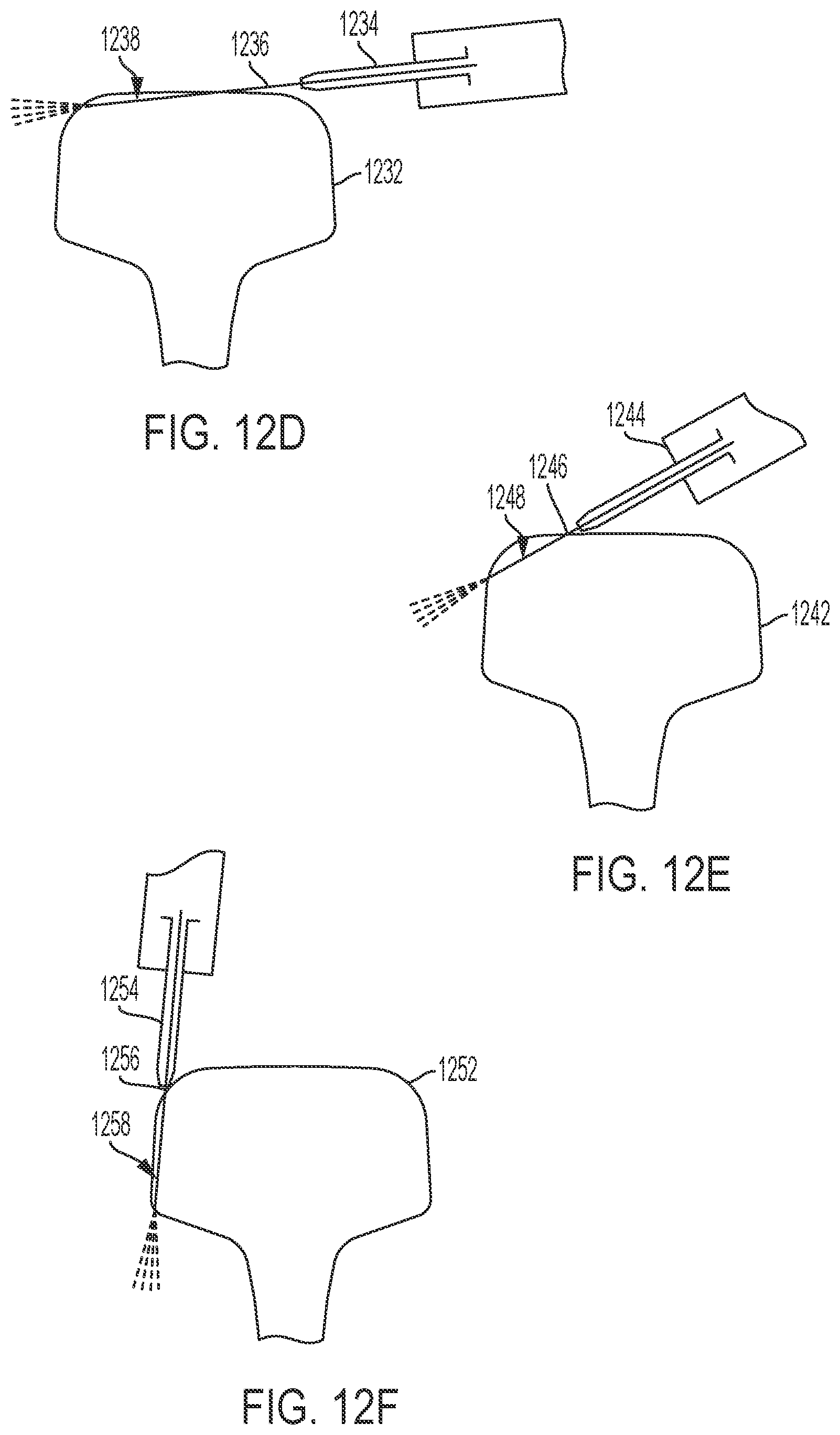 Patent US12448747 Figure 11 – Mobile waterjet rail repair system