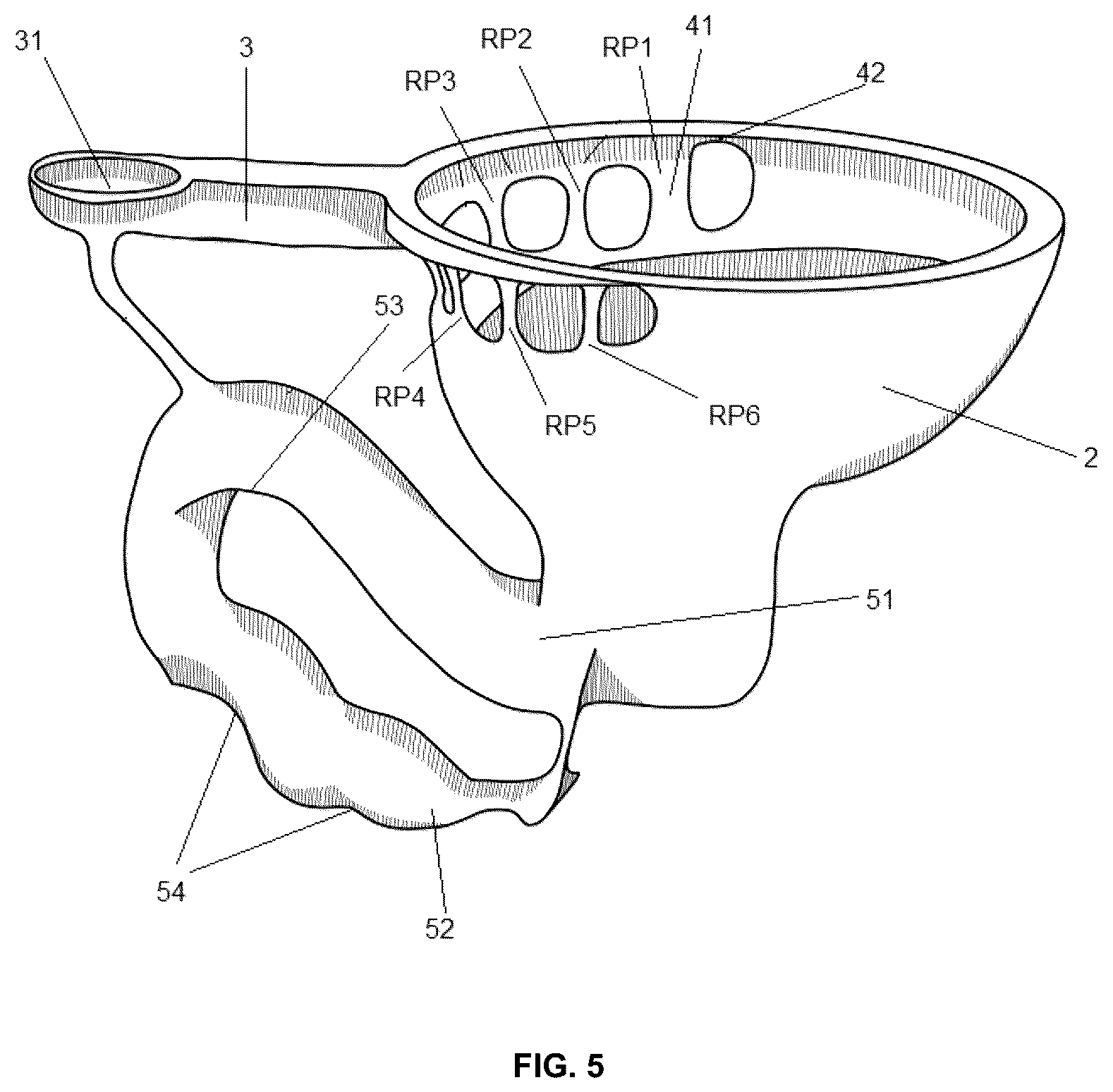 Patent US12448766 Figure 5 – Open-rim toilet with ports and openings in the rim and a wider discharge channel entrance to prevent blockage by waste