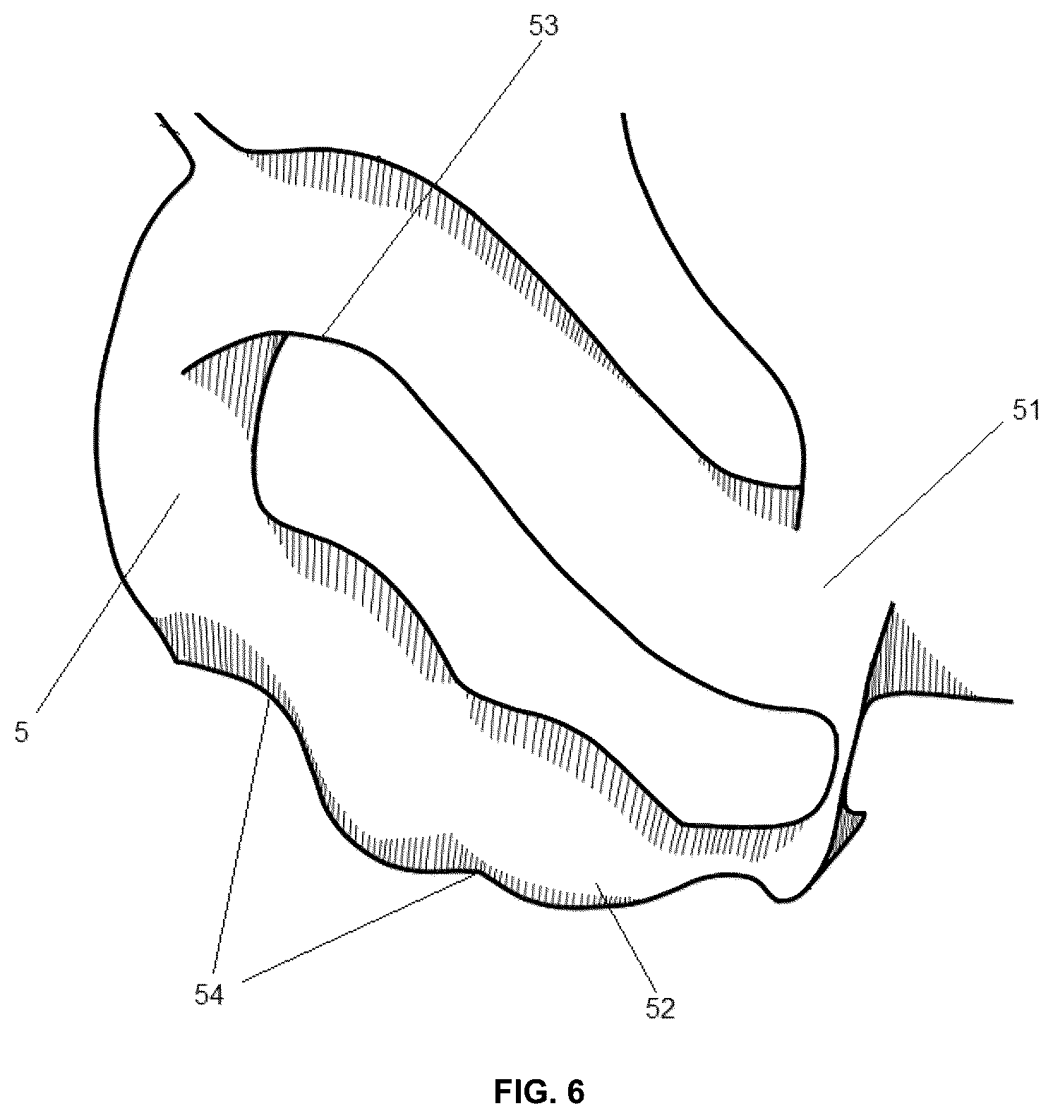 Patent US12448766 Figure 6 – Open-rim toilet with ports and openings in the rim and a wider discharge channel entrance to prevent blockage by waste