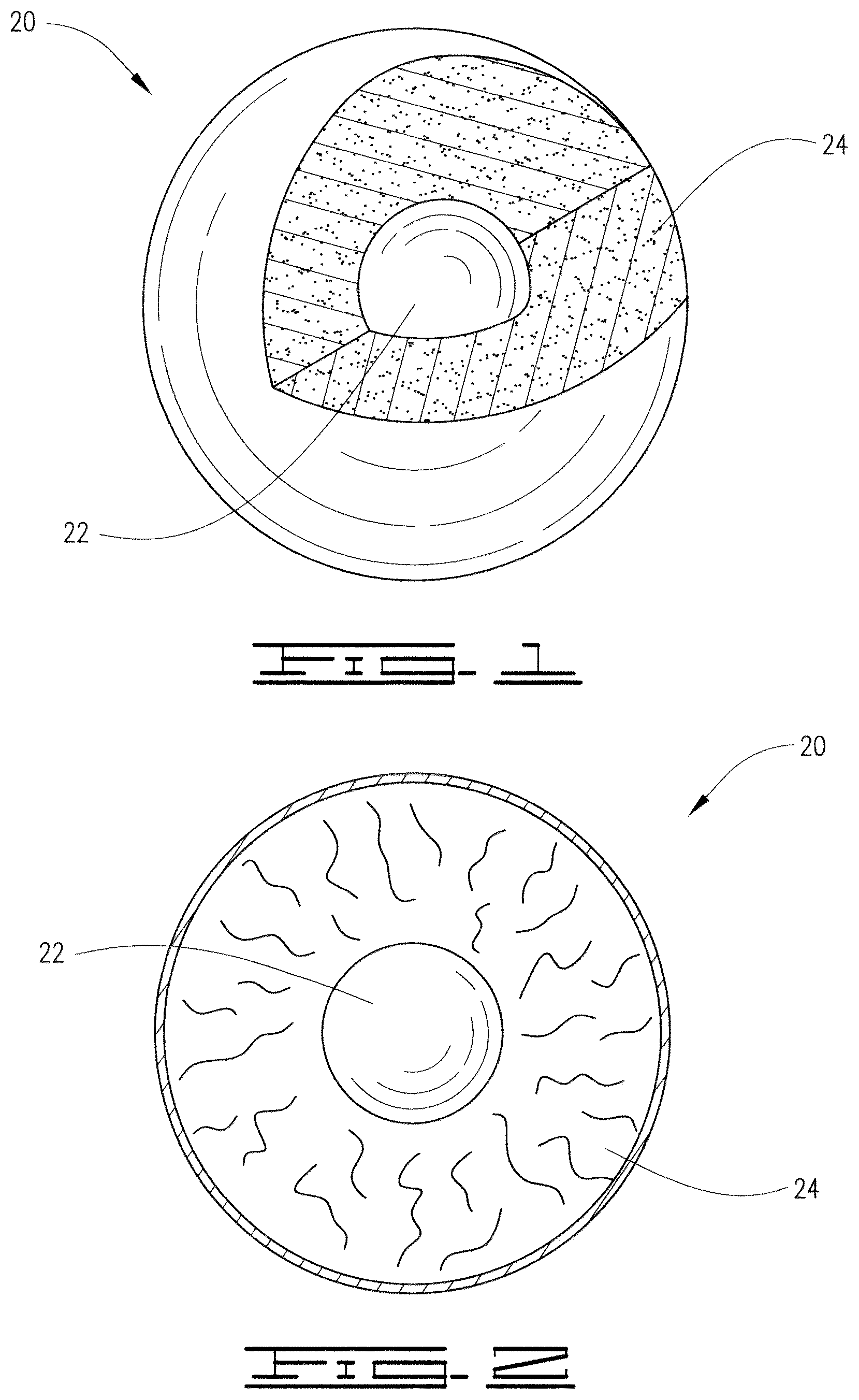 Patent US12448865 Figure 1 – Method for temporary closure of perforation tunnels