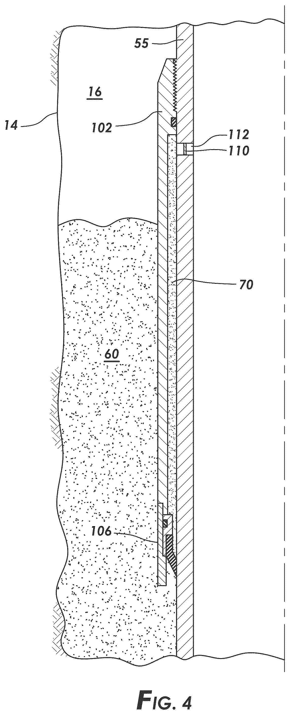 Patent US12448873 Figure 4 – Puddle job with delayed setting of resin