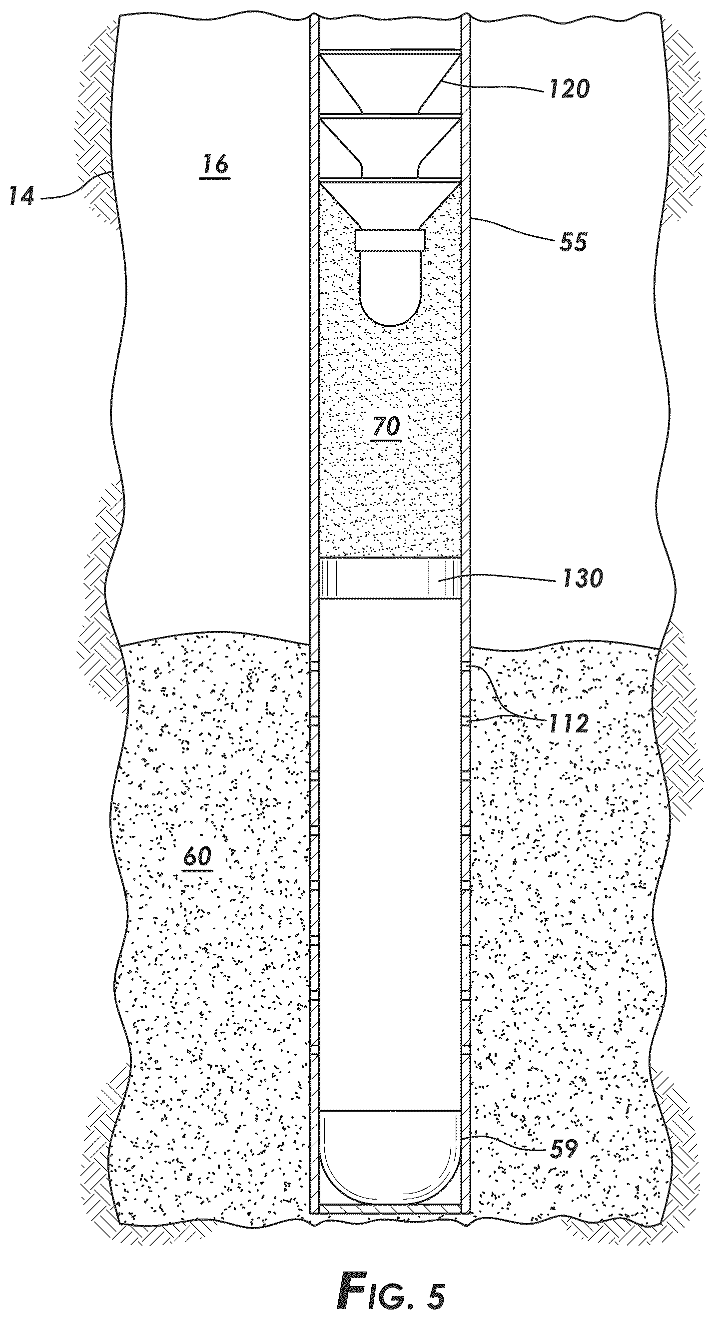 Patent US12448873 Figure 5 – Puddle job with delayed setting of resin