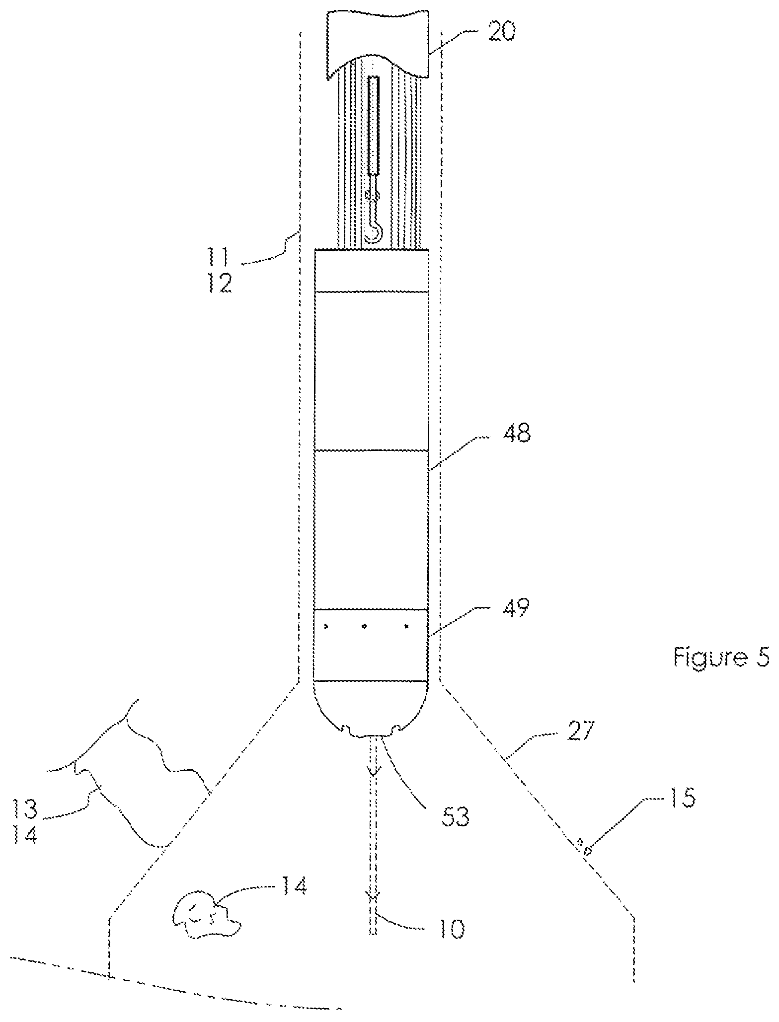 Patent US12448888 Figure 5 – Method and apparatus for using electro-magnetic radiation in narrow vein mining