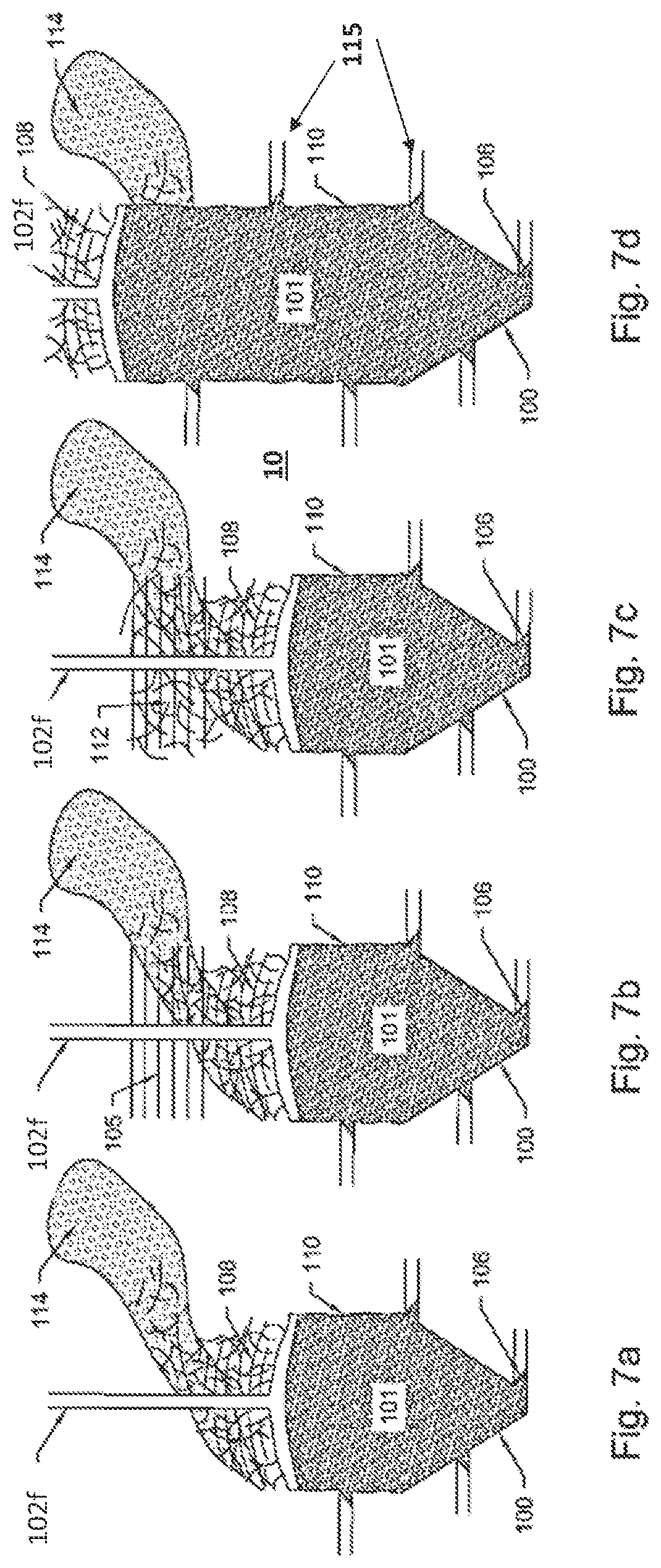 Patent US12448889 Figure 7 – Raise caving method for mining deposits, and a mining infrastructure, monitoring system, machinery, control system and data medium therefor