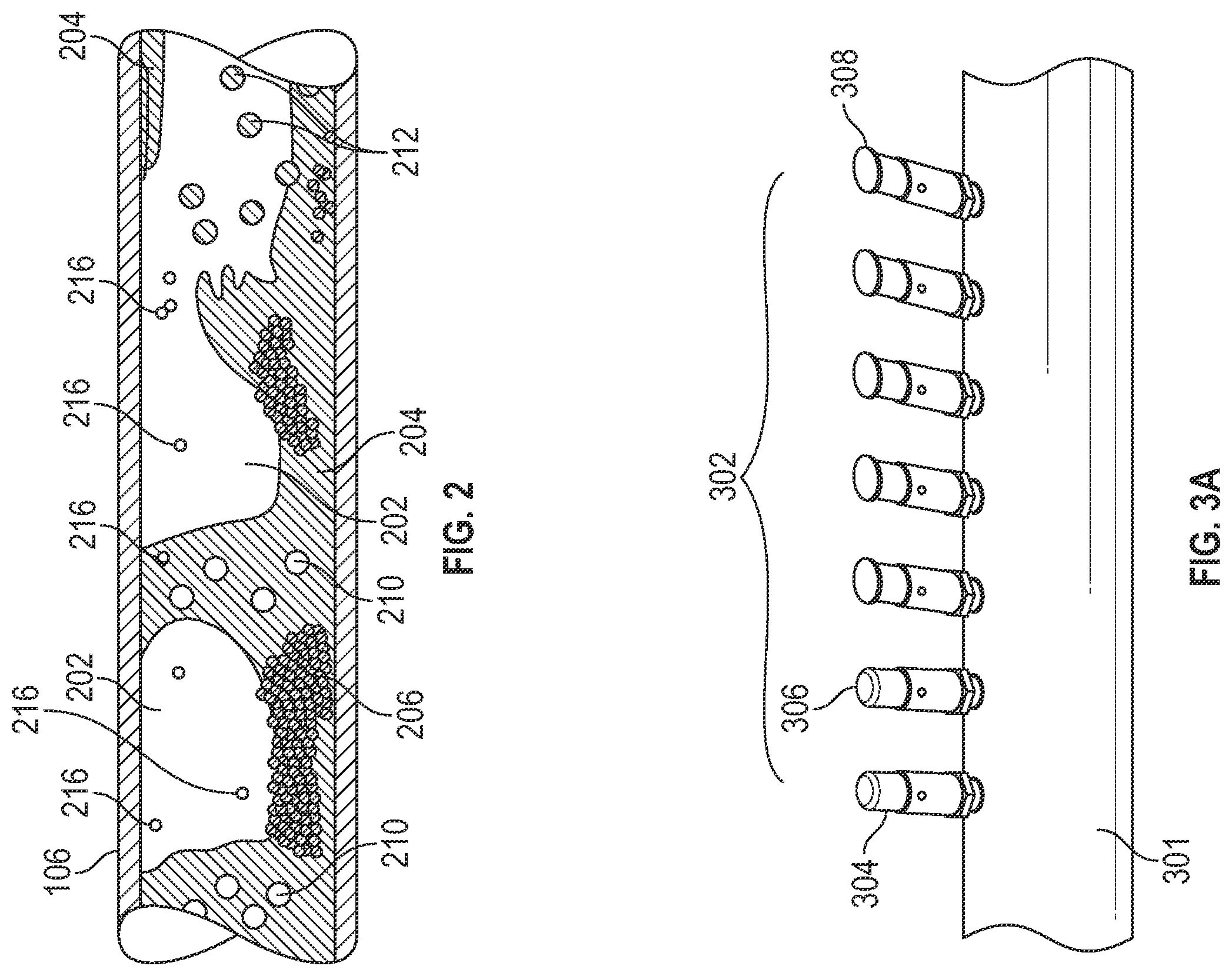 Patent US12455181 Figure 2 – Measurement of bulk flow velocity and mixture sound speed using an array of dynamic pressure sensors