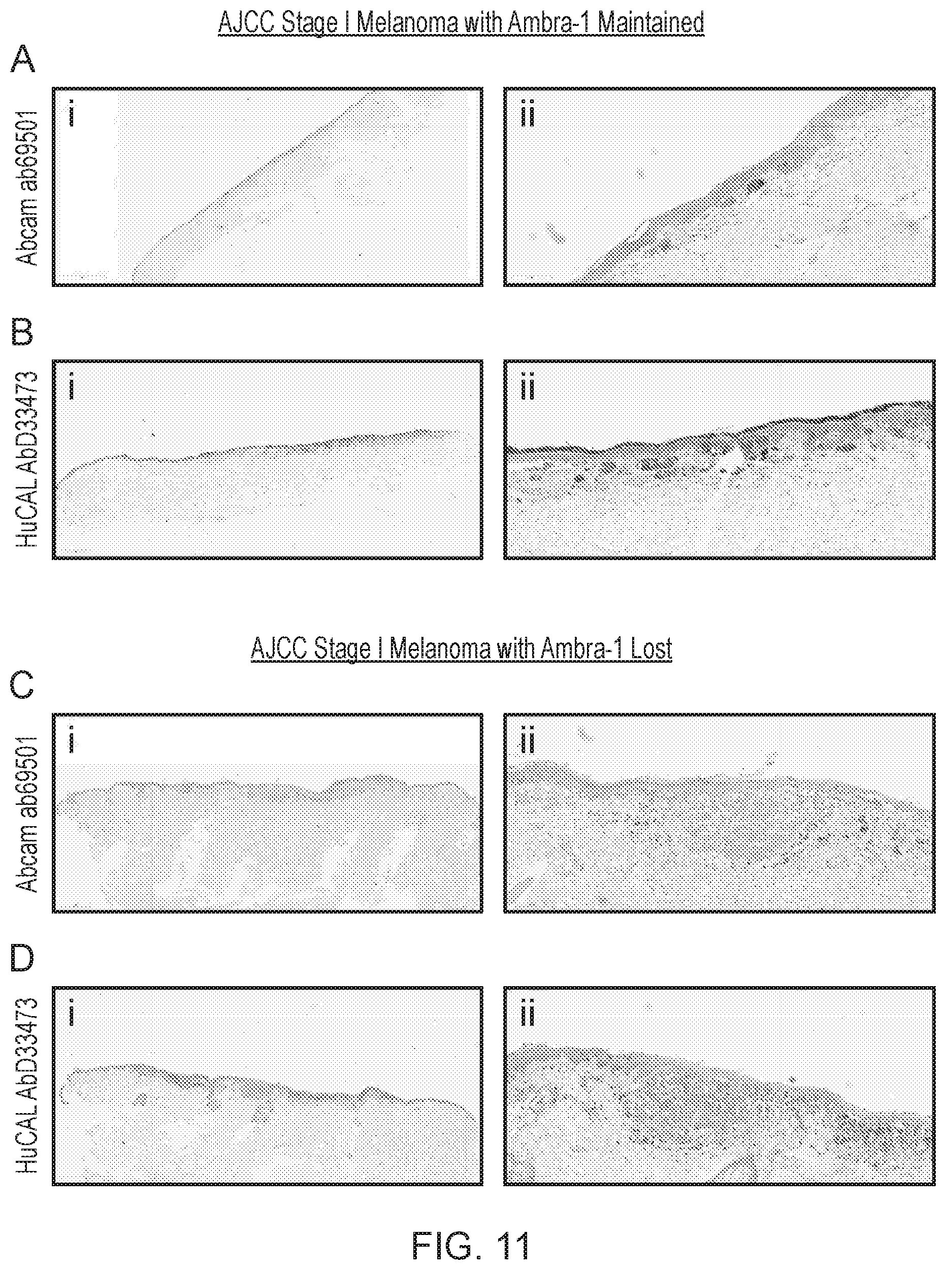 Patent US12455289 Figure 10 – Monoclonal antibodies against loricrin