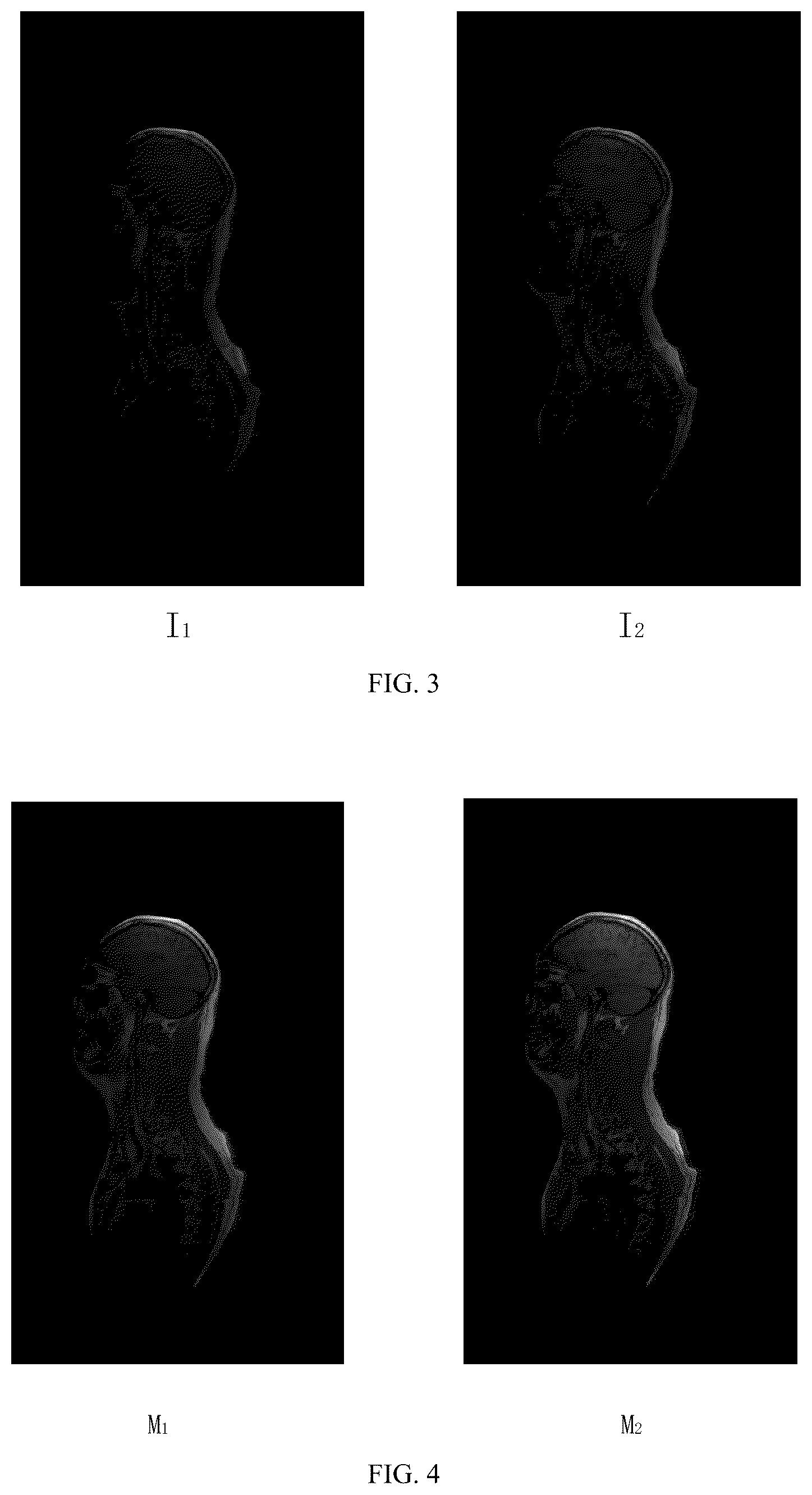 Patent US12455335 Figure 3 – Method and device for water-fat separation of image, computer apparatus, and computer-readable storage medium