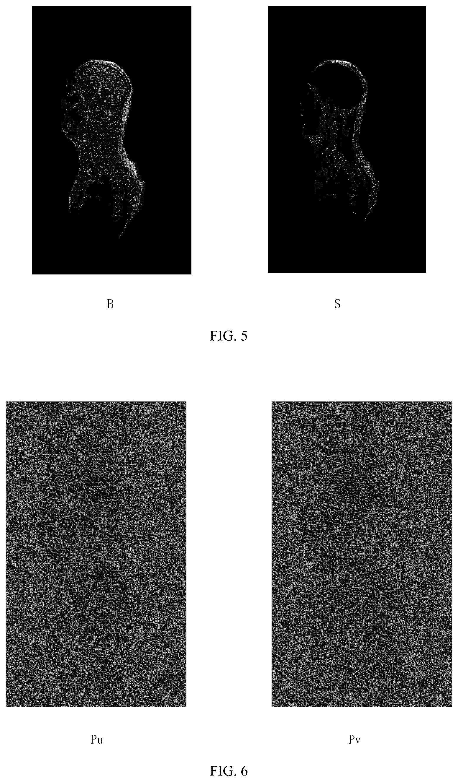 Patent US12455335 Figure 4 – Method and device for water-fat separation of image, computer apparatus, and computer-readable storage medium