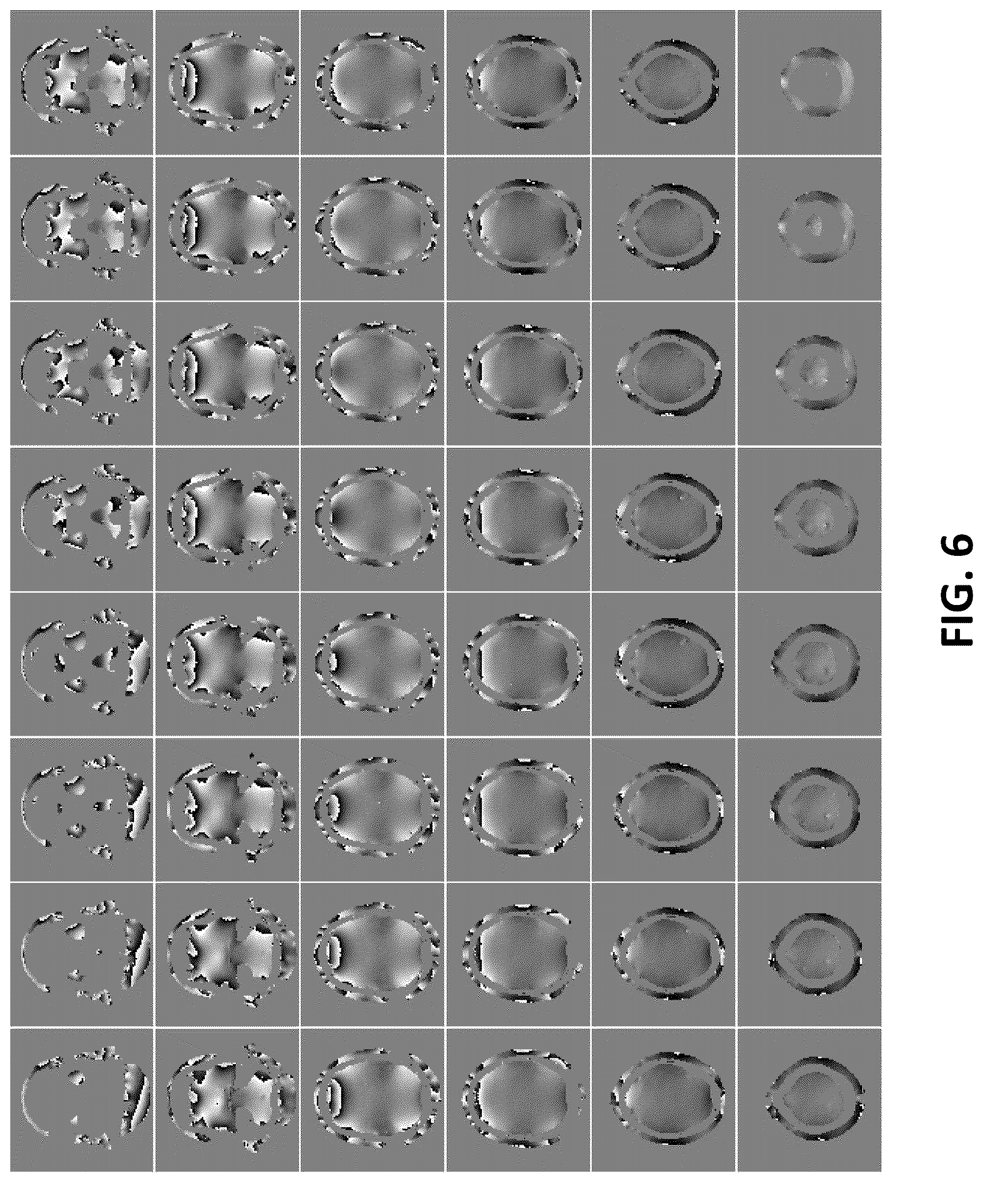 Patent US12455336 Figure 6 – Methods, apparatuses, systems, and computer-readable mediums for magnetic resonance imaging with phase difference operation