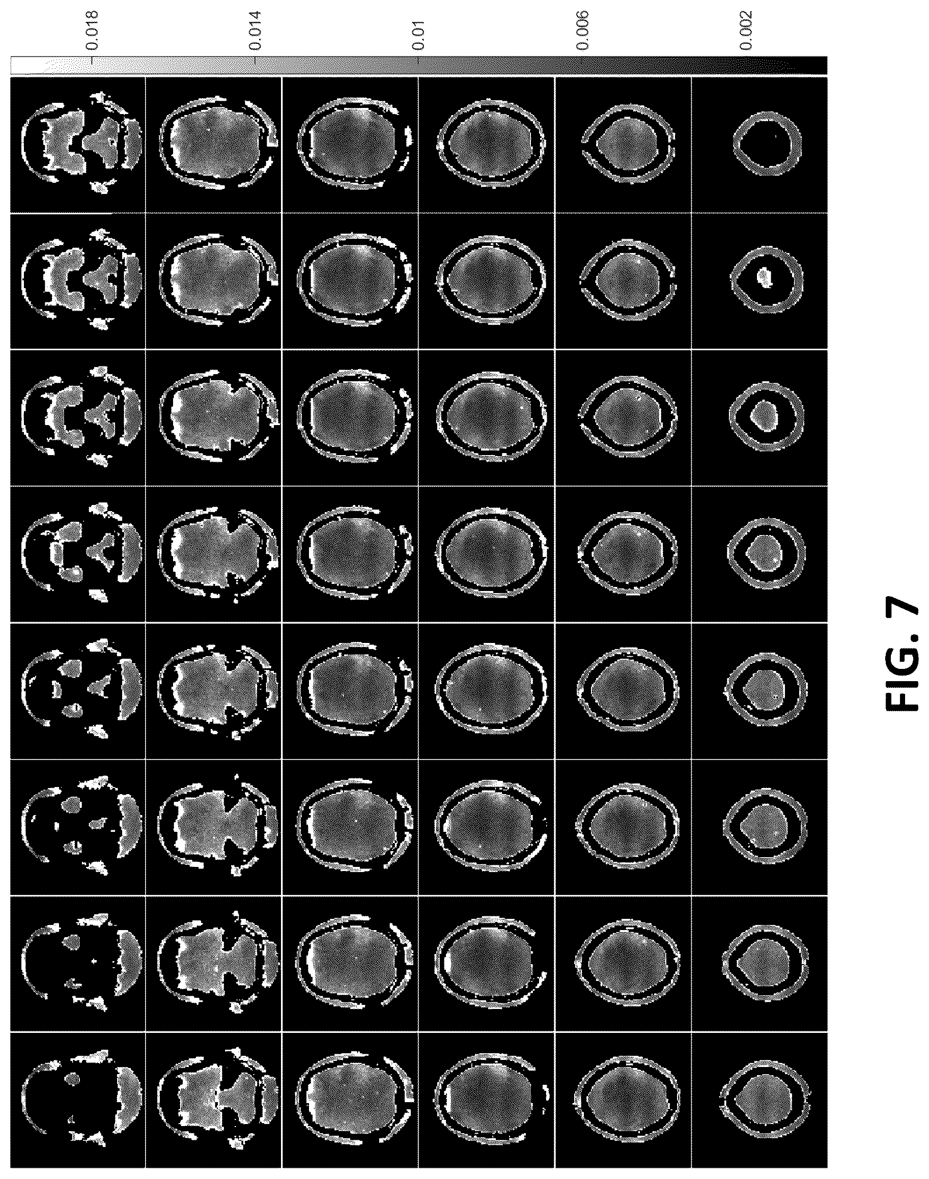 Patent US12455336 Figure 7 – Methods, apparatuses, systems, and computer-readable mediums for magnetic resonance imaging with phase difference operation