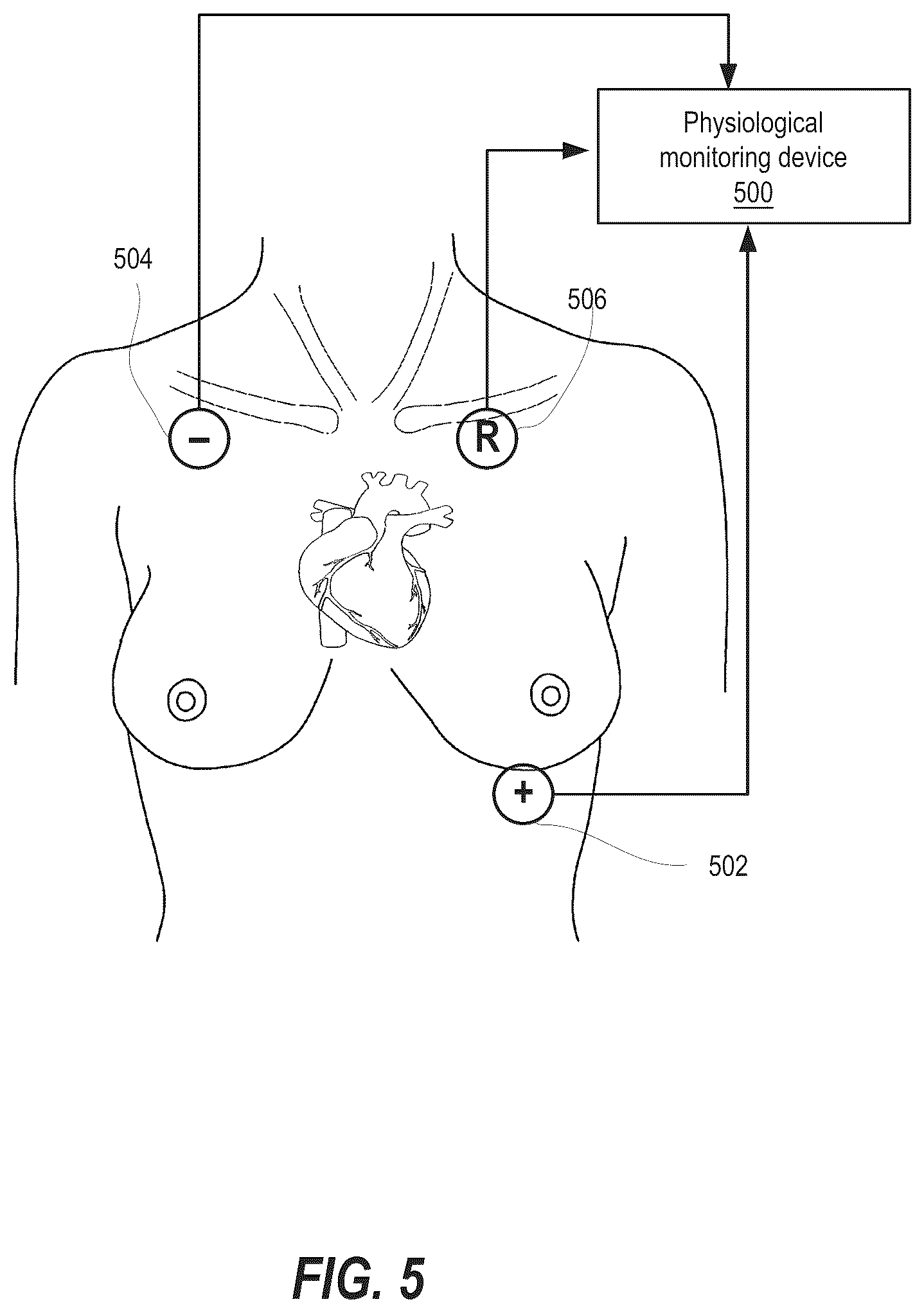 Patent US12455623 Figure 5 – Multiple switching electromyography (EMG) assistive communications device