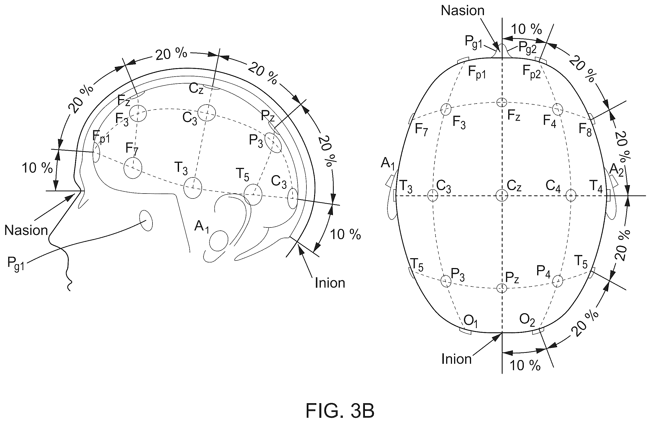 Patent US12455625 Figure 5 – Brain-computer interface with high-speed eye tracking features